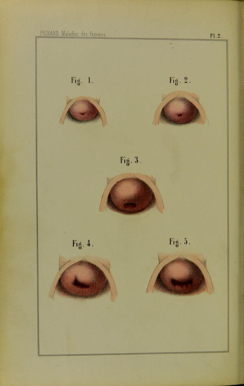 . Maladies ks .Femmes. Pl.2