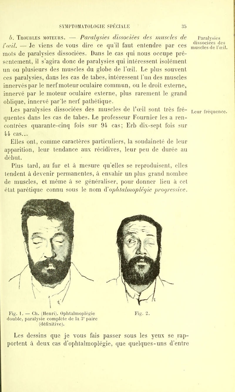 I). Troubles moteurs. — Pamlijsien dissociées des 7nuscles de Paralysies — Je viens de vous dire ce qu'il faut entendre par ces mûsdes'de rœfi. mots de paralysies dissociées. Dans le cas qui nous occupe pré- scntcmenl, il s'agira donc de paralysies qui intéressent isolément un ou plusieurs des muscles du globe de l'œil. Le plus souvent ces paralysies, dans les cas de tabès, intéressent l'un des muscles innervés par le nerf moteur oculaire commun, ou le droit externe, innervé par le moteur oculaire externe, plus rarement le grand oblique, innervé par'le nerf pathétique. Les paralysies dissociées des muscles de l'œil sont très fré- jg^,, fréquence, quentes dans les cas de tabès. Le professeur Fournier les a ren- contrées quarante-cinq fois sur 94 cas; Erb dix-sept fois sur 44 cas... Elles ont, comme caractères particuliers, la soudaineté de leur apparition, leur tendance aux récidives, leur peu de durée au début. Plus tard, au fur et à mesure qu'elles se reproduisent, elles tendent à devenir permanentes, à envahir un plus grand nombre de muscles, et même à se généraliser, pour donner lieu à cet état parétique connu sous le nom (ïophtalmoplérjie progressive. Fig. 1. — Ch. (Henri). Oplilalmoplégie Fig. 2. douijie, paralysie complcle (Je la 3 paire (définilivc). Les dessins que je vous fais passer sous les yeux se rap- portent à deux cas d'ophtalmoplégie, cjue quelques-uns d'entre