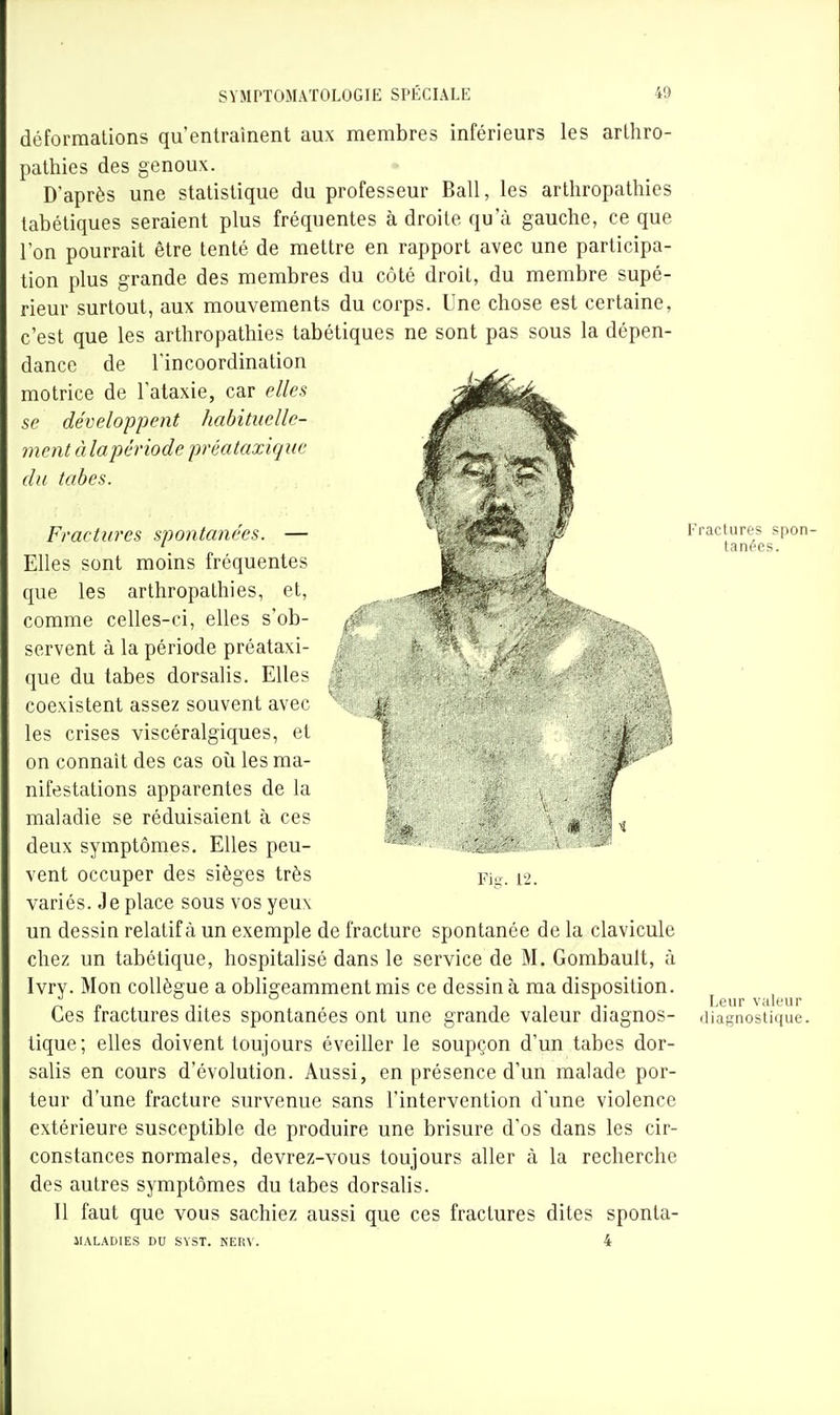 déformations qu'entraînent aux membres inférieurs les arthro- pathies des genoux. D'après une statistique du professeur Bail, les arthropatliies tabétiques seraient plus fréquentes à droite qu'à gauche, ce que l'on pourrait être tenté de mettre en rapport avec une participa- tion plus grande des membres du côté droit, du membre supé- rieur surtout, aux mouvements du corps. Une chose est certaine, c'est que les arthropathies tabétiques ne sont pas sous la dépen- dance de l'incoordination motrice de l'alaxie, car elles se développent habituelle- ment à lapériode préataxique du tabès. Fractures spontanées. — Elles sont moins fréquentes que les arthropathies, et, comme celles-ci, elles s'ob- servent à la période préataxi- que du tabès dorsalis. Elles coexistent assez souvent avec les crises viscéralgiques, et on connaît des cas oîi les ma- nifestations apparentes de la maladie se réduisaient à ces deux symptômes. Elles peu- vent occuper des sièges très variés. Je place sous vos yeux un dessin relatif à un exemple de fracture spontanée de la clavicule chez un tabétique, hospitalisé dans le service de M. Gombault, à Ivry. Mon collègue a obligeamment mis ce dessin à ma disposition. ^ ^^^^ Ces fractures dites spontanées ont une grande valeur diagnos- diagnostique, tique; elles doivent toujours éveiller le soupçon d'un tabès dor- salis en cours d'évolution. Aussi, en présence d'un malade por- teur d'une fracture survenue sans l'intervention d'une violence extérieure susceptible de produire une brisure d'os dans les cir- constances normales, devrez-vous toujours aller à la recherche des autres symptômes du tabès dorsalis. Il faut que vous sachiez aussi que ces fractures dites sponta- JIALADIES DU SVST. NERV. 4