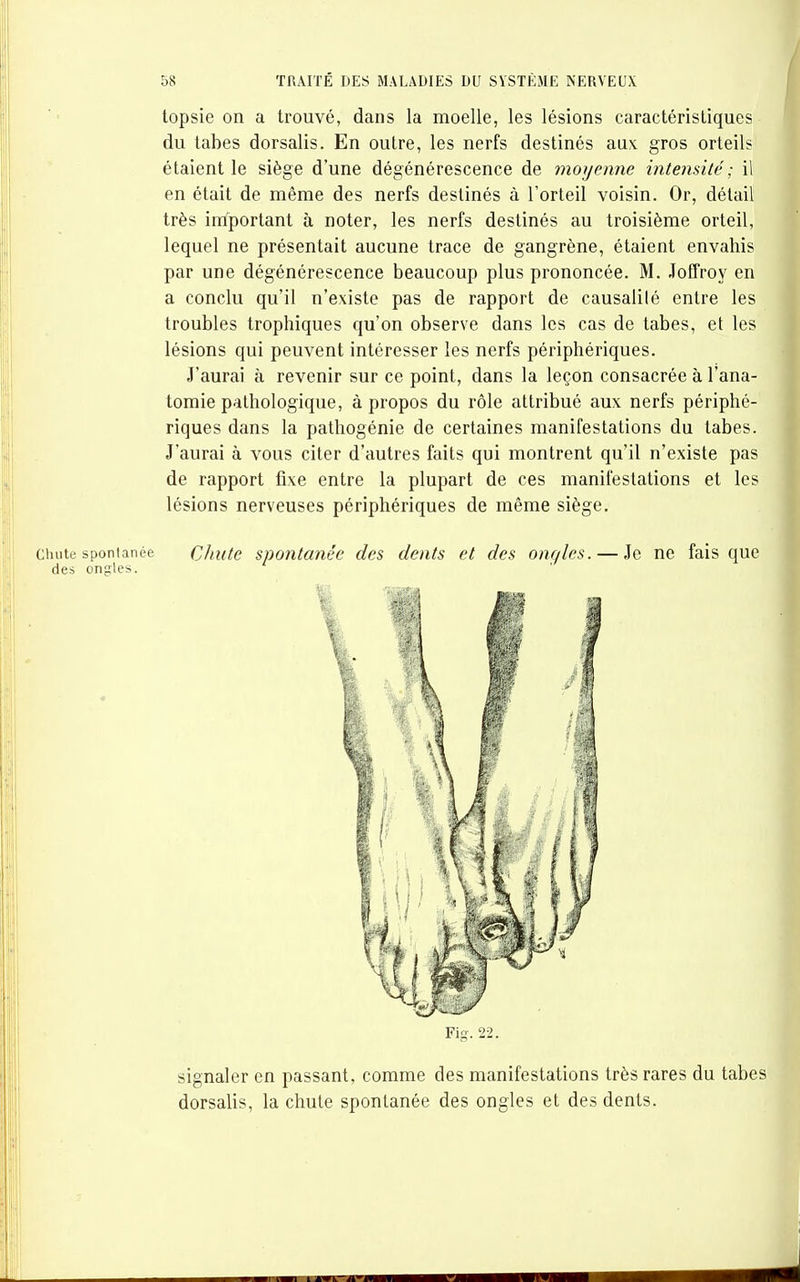 topsie on a trouvé, dans la moelle, les lésions caractéristiques du tabès dorsalis. En outre, les nerfs destinés aux gros orteil? étaient le siège d'une dégénérescence de moyenne intensité ; il en était de même des nerfs destinés à l'orteil voisin. Or, détail très important à noter, les nerfs destinés au troisième orteil, lequel ne présentait aucune trace de gangrène, étaient envahis par une dégénérescence beaucoup plus prononcée. M. Joffroy en a conclu qu'il n'existe pas de rapport de causalilé entre les troubles trophiques qu'on observe dans les cas de tabès, et les lésions qui peuvent intéresser les nerfs périphériques. J'aurai à revenir sur ce point, dans la leçon consacrée à l'ana- tomie pathologique, à propos du rôle attribué aux nerfs périphé- riques dans la pathogénie de certaines manifestations du tabès. J'aurai à vous citer d'autres faits qui montrent qu'il n'existe pas de rapport fixe entre la plupart de ces manifestations et les lésions nerveuses périphériques de même siège. Chute spontanée des ongles. Chute spontanée des dents et des ongles. — Je ne fais que signaler en passant, comme des manifestations très rares du tabès dorsalis, la chute spontanée des ongles et des dents.