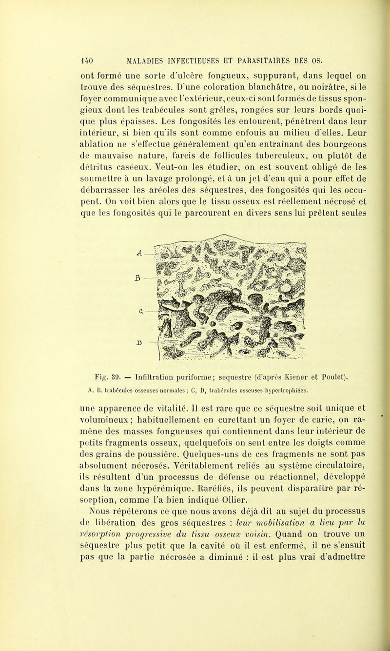 ont formé une sorte d'ulcère fongueux, suppurant, dans lequel on trouve des séquestres. D'une coloration blanchâtre, ou noirâtre, si le foyer communique avec l'extérieur, ceux-ci sont formés de tissus spon- gieux dont les trabécules sont grêles, rongées sur leurs bords quoi- que plus épaisses. Les fongosités les entourent, pénètrent dans leur intérieur, si bien qu'ils sont comme enfouis au milieu d'elles. Leur ablation ne s'effectue généralement qu'en entraînant des bourgeons de mauvaise nature, farcis de follicules tuberculeux, ou plutôt de détritus caséeux. Veut-on les étudier, on est souvent obligé de les soumettre à un lavage prolongé, et à un jet d'eau qui a pour effet de débarrasser les aréoles des séquestres, des fongosités qui les occu- pent. On voit bien alors que le tissu osseux est réellement nécrosé et que les fongosités qui le parcourent en divers sens lui prêtent seules Fig. 39. — Infiltration puriforme ; séquestre (d'après Kiener et Poulet). A, B, trabécules osseuses normales ; C, D, trabécules osseuses hypertrophiées. une apparence de vitalité. Il est rare que ce séquestre soit unique et volumineux; habituellement en curettant un foyer de carie, on ra- mène des masses fongueuses qui contiennent dans leur intérieur de petits fragments osseux, quelquefois on sent entre les doigts comme des grains de poussière. Quelques-uns de ces fragments ne sont pas absolument nécrosés. Véritablement reliés au système circulatoire, ils résultent d'un processus de défense ou réactionnel, développé dans la zone hypérémique. Raréfiés, ils peuvent disparaître par ré- sorption, comme l'a bien indiqué Ollier. Nous répéterons ce que nous avons déjà dit au sujet du processus de libération des gros séquestres : leur mobilisation a lieu par la résorption progressive du tissu osseux voisin. Quand on trouve un séquestre plus petit que la cavité où il est enfermé, il ne s'ensuit pas que la partie nécrosée a diminué : il est plus vrai d'admettre