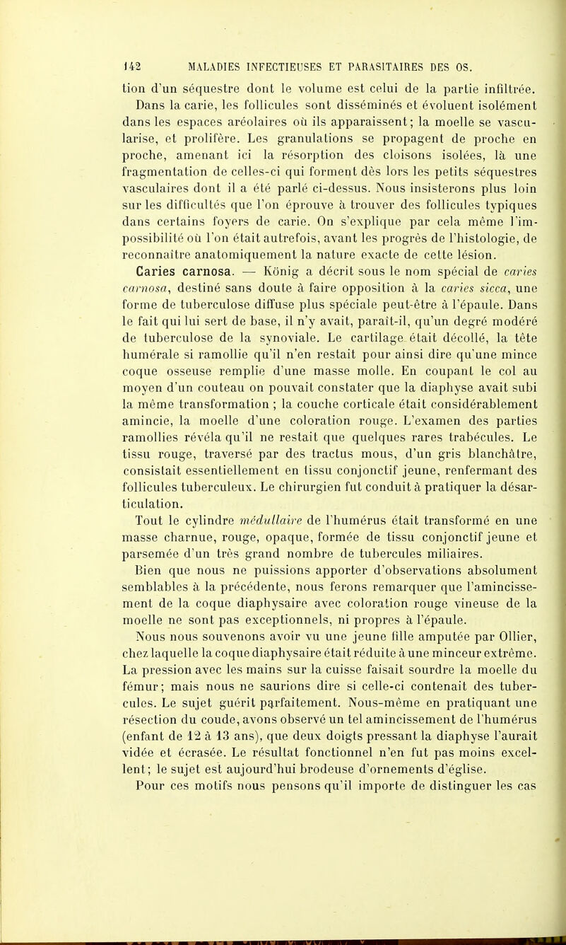 tion d'un séquestre dont le volume est celui de la partie infiltrée. Dans la carie, les follicules sont disséminés et évoluent isolément dans les espaces aréolaires où ils apparaissent; la moelle se vascu- larise, et prolifère. Les granulations se propagent de proche en proche, amenant ici la résorption des cloisons isolées, là une fragmentation de celles-ci qui forment dès lors les petits séquestres vasculaires dont il a été parlé ci-dessus. Nous insisterons plus loin sur les difficultés que l'on éprouve à trouver des follicules typiques dans certains foyers de carie. On s'explique par cela même l'im- possibilité où l'on était autrefois, avant les progrès de l'histologie, de reconnaître anatomiquement la nature exacte de cette lésion. Caries carnosa. — Kônig a décrit sous le nom spécial de caries carnosa, destiné sans doute à faire opposition à la caries sicca, une forme de tuberculose diffuse plus spéciale peut-être à l'épaule. Dans le fait qui lui sert de base, il n'y avait, paraît-il, qu'un degré modéré de tuberculose de la synoviale. Le cartilage était décollé, la tête numérale si ramollie qu'il n'en restait pour ainsi dire qu'une mince coque osseuse remplie d'une masse molle. En coupant le col au moyen d'un couteau on pouvait constater que la diaphyse avait subi la même transformation ; la couche corticale était considérablement amincie, la moelle d'une coloration rouge. L'examen des parties ramollies révéla qu'il ne restait que quelques rares trabécules. Le tissu rouge, traversé par des tractus mous, d'un gris blanchâtre, consistait essentiellement en tissu conjonctif jeune, renfermant des follicules tuberculeux. Le chirurgien fut conduit à pratiquer la désar- ticulation. Tout le cylindre médullaire de l'humérus était transformé en une masse charnue, rouge, opaque, formée de tissu conjonctif jeune et parsemée d'un très grand nombre de tubercules miliaires. Bien que nous ne puissions apporter d'observations absolument semblables à la précédente, nous ferons remarquer que l'amincisse- ment de la coque diaphysaire avec coloration rouge vineuse de la moelle ne sont pas exceptionnels, ni propres à l'épaule. Nous nous souvenons avoir vu une jeune fille amputée par Ollier, chez laquelle la coque diaphysaire était réduite à une minceur extrême. La pression avec les mains sur la cuisse faisait sourdre la moelle du fémur; mais nous ne saurions dire si celle-ci contenait des tuber- cules. Le sujet guérit parfaitement. Nous-même en pratiquant une résection du coude, avons observé un tel amincissement de l'humérus (enfant de 12 à 13 ans), que deux doigts pressant la diaphyse l'aurait vidée et écrasée. Le résultat fonctionnel n'en fut pas moins excel- lent; le sujet est aujourd'hui brodeuse d'ornements d'église. Pour ces motifs nous pensons qu'il importe de distinguer les cas X