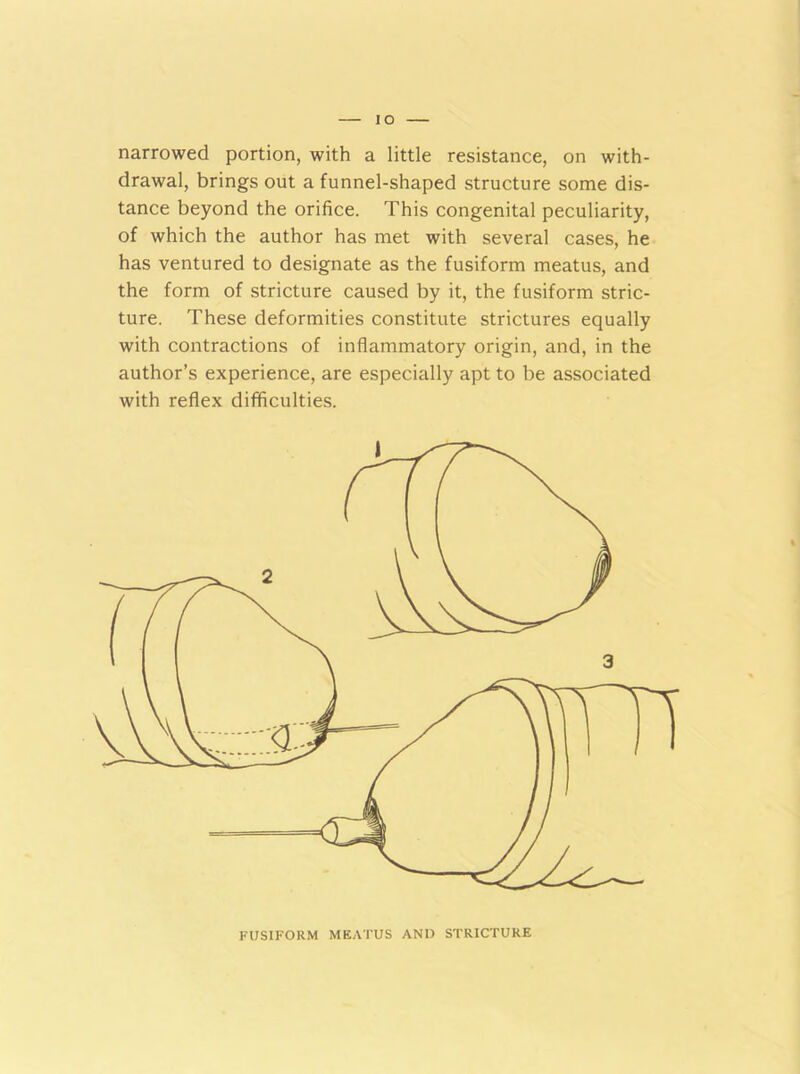 narrowed portion, with a little resistance, on with- drawal, brings out a funnel-shaped structure some dis- tance beyond the orifice. This congenital peculiarity, of which the author has met with several cases, he has ventured to designate as the fusiform meatus, and the form of stricture caused by it, the fusiform stric- ture. These deformities constitute strictures equally with contractions of inflammatory origin, and, in the author’s experience, are especially apt to be associated with reflex difficulties. FUSIFORM MEATUS AND STRICTURE