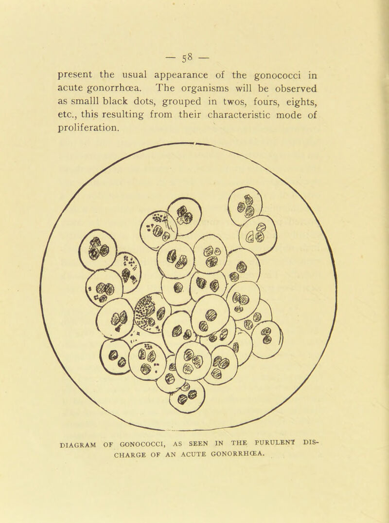 SB present the usual appearance of the gonococci in acute gonorrhoea. The organisms will be observed as smalll black dots, grouped in twos, fours, eights, etc., this resulting from their characteristic mode of proliferation. DIAGRAM OF GONOCOCCI, AS SEEN IN THE PURULENT DIS- CHARGE OF AN ACUTE GONORRHOEA.