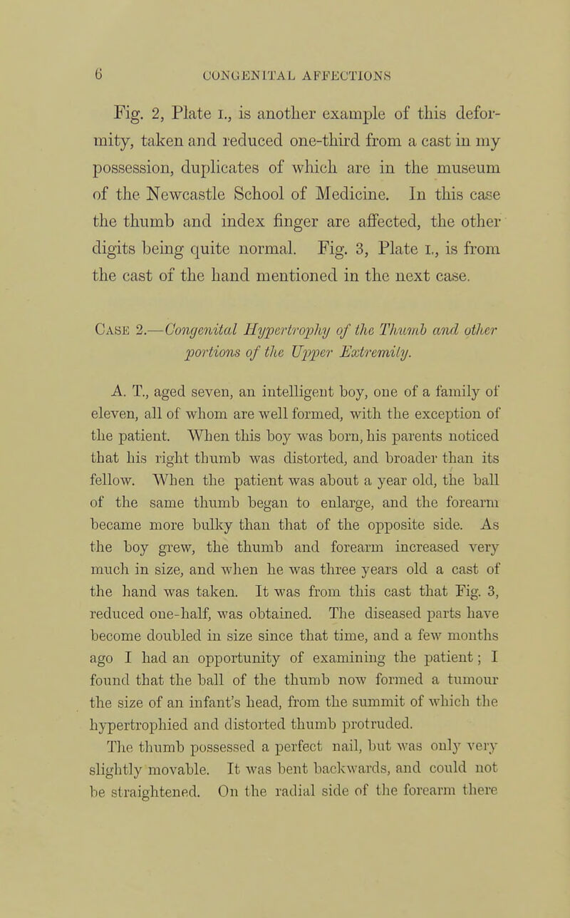 Fig. 2, Plate i., is another examj)le of this defor- mity, taken and reduced one-third from a cast in my possession, duplicates of which are in the museum of the Newcastle School of Medicine. In this case the thumb and index finger are aflPected, the other digits being quite normal. Fig. 3, Plate i,, is from the cast of the hand mentioned in the next case. Case 2.—-Congenital Hypertrophy of the 'Thumb and other portions of the U2Jper Extremity. A. T., aged seven, an intelligent boy, one of a family of eleven, all of whom are well formed, with the exception of the patient. When this boy was born, his parents noticed that his right thumb was distorted, and broader than its fellow. When the patient was about a year old, the baU. of the same thumb began to enlarge, and the forearm became more bulky than that of the opposite side. As the boy grew, the thumb and forearm increased very much in size, and when he was three years old a cast of the hand was taken. It was from this cast that Fig. 3, reduced one-half, was obtained. The diseased parts have become doubled in size since that time, and a few months ago I had an opportunity of examining the patient; I found that the ball of the thumb now formed a tumour the size of an infant's head, from the summit of which the hypertrophied and distorted thumb protruded. The thumb possessed a perfect nail, but was only very slightly movable. It was bent backwards, and could not be straightened. On the radial side of Die forearm there