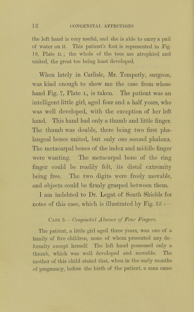 the left hand is very useful, and she is able to cany a pail of water on it. This patient's foot is represented in Fig. ] 8, Plate II.; the wliole of the toes are atrophied and united, the great toe being least developed. When lately in Carlisle, Mr, Temperly, surgeon, was kind enough to show me the case from whose hand Fig. 7, Plate i., is taken. The patient was an intelligent little girl, aged four and a half years, who was well developed, with the exception of her left hand. This hand had only a thumb and little finger. The thumb was double, there being two first pha- langeal bones united, but only one second phalanx. The metacarpal bones of the index and middle finger were wanting. The metacarpal bone of the ring finger could be readily felt, its distal extremity being free. The two digits were freely movable, and objects could be firmly grasped between them. I am indebted to Dr. Legat of South Sliields for notes of this case, which is illustrated by Fig. 3 5 :— Case 5.—Congenital Absence of Foilv Fingers. The patient, a little girl aged three years, was one of a family of five children, none of whom presented any de- formity except herself. The left hand possessed only a thumb, which was well developed and movable. Tlie mother of this child stated that, when in the early months of pregnancy, before the birth of the patient, a man came