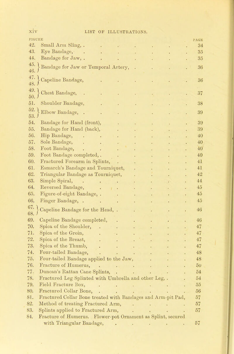FIGURE l'AOK 42. Small Arm Sling, ....... 34 43. Eye Bandage, ....... 35 44. Bandage for Jaw, ....... 35 45 1  j- Bandage for Jaw or Temporal Artery, . . . .36 J7-|Capel ine Bandage, ...... 36 49. } Chest Bandage, ....... 37 50. J 51. Shoulder Bandage, ...... 38 52- I Elbow Bandage, ....... 39 53. J 54. Bandage for Hand (front), ..... 39 55. Bandage for Hand (back), . . . . .39 56. Hip Bandage, ....... 40 57. Sole Bandage, ....... 40 58. Foot Bandage, ....... 40 59. Foot Bandage completed,...... 40 60. Fractured Forearm in Splints, . . . . .41 61. Esmarch's Bandage and Tourniquet, . . . .41 62. Triangular Bandage as Tourniquet, . . . .42 63. Simple Spiral, ....... 44 64. Reversed Bandage, . , . . . . .45 65. Figure-of-eight Bandage, ...... 45 66. Finger Bandage, ....... 45 67 1 V Capeline Bandage for the Head, . . . 46 68. J 69. Capeline Bandage completed, ..... -16 70. Spica of the Shoulder, ...... 47 71. Spica of the Groin, ...... 47 72. Spica of the Breast, . . . ' . . .47 73. Spica of the Thumb, ...... 47 74. Four-tailed Bandage, ...... 4S 75. Four-tailed Bandage applied to the Jaw, . . .48 76. Fracture of Humerus, ...... 5U 77- Duncan's Rattan Cane Splints, .... .54 7S. Fractured Leg Splinted with Umbrella and other Leg, . . 54 79. Field Fracture Box, ...... 55 80. Fractured Collar Bone, ...... 56 SI. Fractured Collar Bone treated with Bandages and Arm-pit Pad, 57 82. Method of treating Fractured Arm, . . . .57 83. Splints applied to Fractured Arm, . . . .57 84. Fracture of Humerus. Flower-pot Ornament as Splint, secured with Triangular Bandage, ..... 57