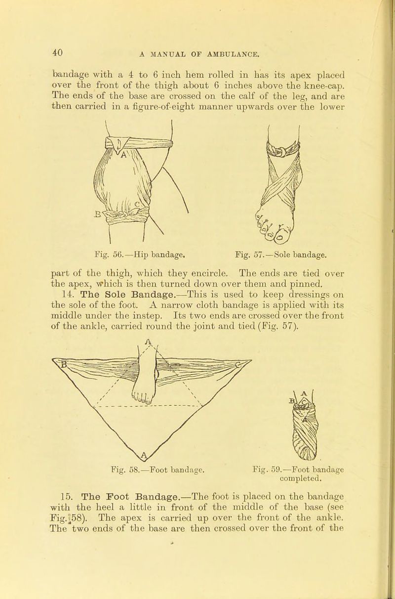 bandage with a 4 to 6 inch hem rolled in has its apex placed over the front of the thigh about 6 inches above the knee-cap. The ends of the base are crossed on the calf of the leg, and are then carried in a figure-of-eight manner upwards over the lower Fig. 56.—Hip bandage. Fig. 57.—Sole bandage. part of the thigh, which they encircle. The ends are tied over the apex, which is then turned down over them and pinned. 14. The Sole Bandage.—-This is used to keep dressings on the sole of the foot. A narrow cloth bandage is applied with its middle under the instep. Its two ends are crossed over the front of the ankle, carried round the joint and tied (Fig. 57). Fig. 58.—Foot bandage. Fig. 59.—Foot bandage completed. 15. The Foot Bandage.—The foot is placed on the bandage with the heel a little in front of the middle of the base (see Fig.^58). The apex is carried up over the front of the ankle. The two ends of the base are then crossed over the front of the