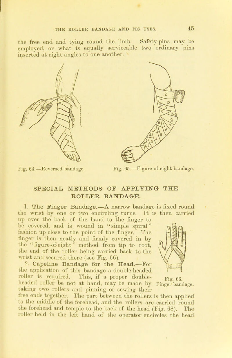the free end and tying round the limb. Safety-pins may be employed, or what is equally serviceable two ordinary pins inserted at right angles to one another. Fig. 64.—Reversed bandage. Fig. 65.—Figure-of-eight bandage. SPECIAL METHODS OF APPLYING THE ROLLER BANDAGE. 1. The Finger Bandage.—A narrow bandage is fixed round the wrist by one or two encircling turns. It is then carried up over the back of the hand to the finger to be covered, and is wound in  simple spiral fashion up close to the point of the finger. The finger is then neatly and firmly covered in by the  figure-of-eight method from tip to root, the end of the roller being carried back to the wrist and secured there (see Fig. 66). 2. Capeline Bandage for the Head.—For the application of this bandage a double-headed roller is required. This, if a proper double- headed roller be not at hand, may be made by Finger bandage, taking two rollers and pinning or sewing their free ends together. The part between the rollers is then applied to the middle of the forehead, and the rollers are carried round the forehead and temple to the back of the head (Fig. 68). The roller held in the left hand of the operator encircles the head