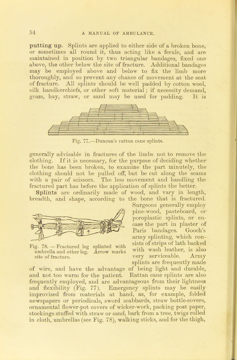 putting up. Splints are applied to either side of a broken bone, or sometimes all round it, thus acting like a ferule, and are maintained in position by two triangular bandages, fixed one above, the other below the site of fracture. Additional bandages may be employed above and below to fix the limb more thoroughly, and so prevent any chance of movement at the seat of fracture. All splints should be well padded by cotton wool, silk handkerchiefs, or other soft material; if necessity demand, grass, hay, straw, or sand may be used for padding. It is Fig. 77.—Duncan's rattan cane splints. generally advisable in fractures of the limbs not to remove the clothing. If it is necessary, for the purpose of deciding whether the bone has been broken, to examine the part minutely, the clothing should not be pulled off, but be cut along the seams with a pair of scissors. The less movement and handling the fractured part has before the application of splints the better. Splints are ordinarily made of wood, and vary in length, breadth, and shape, according to the bone that is fractured. Surgeons generally employ rfQ pine-wood, pasteboard, or poroplastic splints, or en- case the part in plaster of Paris bandages. Gooch's army splinting, which con- sists of strips of lath backed with wash leather, is also very serviceable. Army splints are frequently made of wire, and have the advantage of being light and durable, and not too warm for the patient. Rattan cane splints are also frequently employed, and are advantageous from their lightness and flexibility (Fig. 77). Emergency splints may be easily improvised from materials at hand, as, for example, folded newspapers or periodicals, sword scabbards, straw bottle-covers, ornamental flower-pot covers of wicker-work, packing post paper, stockings stuffed with straw or sand, bark from a tree, twigs rolled in cloth, umbrellas (see Fig. 78), walking sticks, and for the thigh, Fig. 78.—Fractured leg splinted with umbrella and other leg. Arrow marks site of fracture.