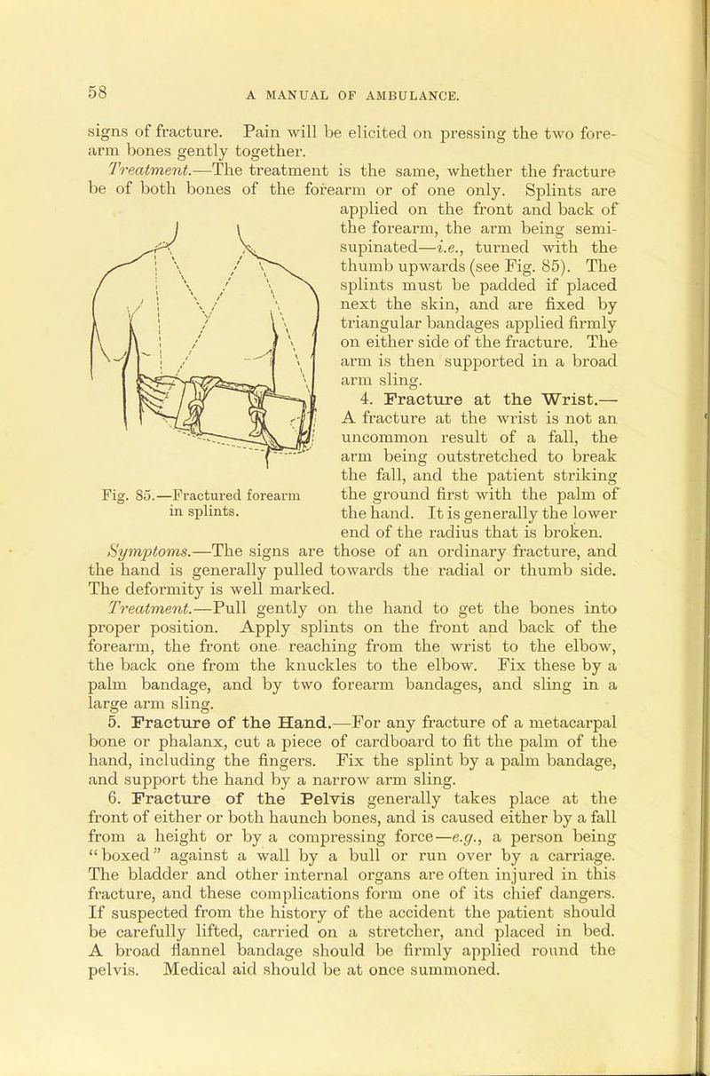 Fig. So.—Fractured forearm in splints. signs of fracture. Pain will be elicited on pressing the two fore- arm bones gently together. Treatment.—The treatment is the same, whether the fracture be of both bones of the forearm or of one only. Splints are apjilied on the front and back of the forearm, the arm being semi- supinated—i.e., turned with the thumb upwards (see Fig. 85). The splints must be padded if placed next the skin, and are fixed by triangular bandages applied firmly on either side of the fracture. The arm is then supported in a broad arm sling. 4. Fracture at the Wrist.— A fracture at the wrist is not an uncommon result of a fall, the arm being outstretched to break the fall, and the patient striking the ground first with the palm of the hand. It is generally the lower end of the radius that is broken. Hymptoms.—The signs are those of an ordinary fracture, and the hand is generally pulled towards the radial or thumb side. The deformity is well marked. Treatment.—Pull gently on the hand to get the bones into proper position. Apply splints on the front and back of the forearm, the front one reaching from the wrist to the elbow, the back one from the knuckles to the elbow. Fix these by a palm bandage, and by two forearm bandages, and sling in a large arm sling. 5. Fracture of the Hand.—For any fracture of a metacarpal bone or phalanx, cut a piece of cardboard to fit the palm of the hand, including the fingers. Fix the splint by a palm bandage, and support the hand by a narrow arm sling. 6. Fracture of the Pelvis generally takes place at the front of either or both haunch bones, and is caused either by a fall from a height or by a compressing force—e.g., a person being boxed against a wall by a bull or run over by a carriage. The bladder and other internal organs are often injured in this fracture, and these complications form one of its chief dangers. If suspected from the history of the accident the patient should be carefully lifted, carried on a stretcher, and placed in bed. A broad flannel bandage should be firmly applied round the pelvis. Medical aid should be at once summoned.