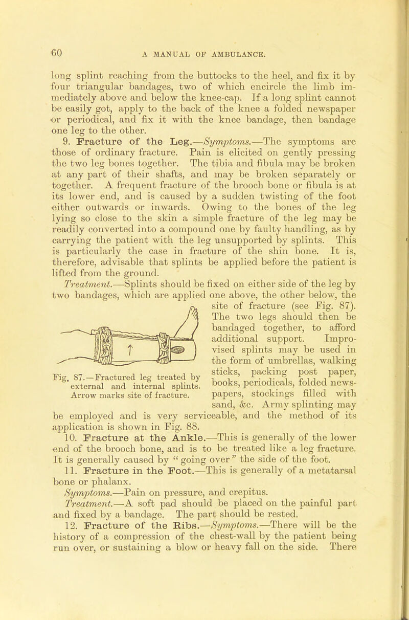 long splint reaching from the buttocks to the heel, and fix it by four triangular bandages, two of which encircle the limb im- mediately above and below the knee-cap. If a long splint cannot be easily got, apply to the back of the knee a folded newspaper •or periodical, and fix it with the knee bandage, then bandage one leg to the other. 9. Fracture of the Leg.—Symptoms.—The symptoms are those of ordinary fracture. Pain is elicited on gently pressing the two leg bones together. The tibia and fibula may be broken at any part of their shafts, and may be broken separately or together. A frequent fracture of the brooch bone or fibula is at its lower end, and is caused by a sudden twisting of the foot either outwards or inwards. Owing to the bones of the leg lying so close to the skin a simple fracture of the leg may be readily converted into a compound one by faulty handling, as by carrying the patient with the leg unsupported by splints. This is particularly the case in fracture of the shin bone. It is, therefore, advisable that splints be applied before the patient is lifted from the ground. Treatment.—Splints should be fixed on either side of the leg by two bandages, which are applied one above, the other below, the be employed and is very serviceable, and the method of its application is shown in Fig. 88. 10. Fracture at the Ankle.—This is generally of the lower end of the brooch bone, and is to be treated like a leg fracture. It is generally caused by  going over  the side of the foot. 11. Fracture in the Foot.—This is generally of a metatarsal bone or phalanx. Symptoms.—Pain on pressure, and crepitus. Treatment.—A soft pad should be placed on the painful part and fixed by a bandage. The part should be rested. 12. Fracture of the Ribs.—Symptoms.—There will be the history of a compression of the chest-wall by the patient being run over, or sustaining a blow or heavy fall on the side. There Fig. S7-—Fractured leg treated by- external arid internal splints. Arrow marks site of fracture. site of fracture (see Pig. 87). The two legs should then be bandaged together, to afford additional support. Impro- vised splints may be used in the form of umbrellas, walking sticks, packing post paper, books, periodicals, folded news- papers, stockings filled with sand, &c. Army splinting may