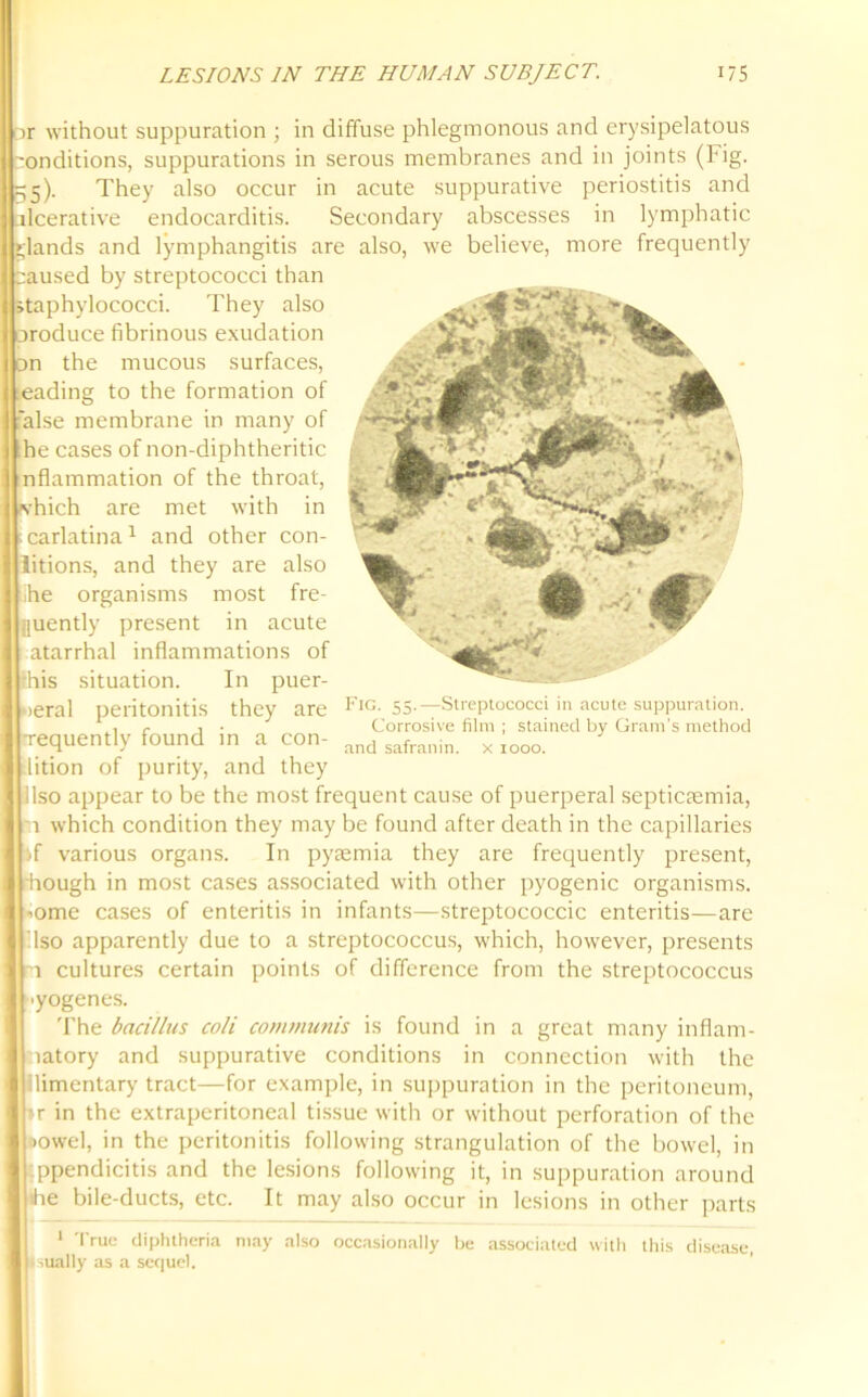 r without suppuration ; in diffuse phlegmonous and erysipelatous 'onditions, suppurations in serous membranes and in joints (Fig. 5). They also occur in acute suppurative periostitis and ulcerative endocarditis. Secondary abscesses in lymphatic glands and lymphangitis are also, we believe, more frequently :aused by streptococci than staphylococci. They also oroduce fibrinous exudation on the mucous surfaces, leading to the formation of alse membrane in many of he cases of non-diphtheritic nflammation of the throat, tvhich are met with in carlatina1 and other con- litions, and they are also :he organisms most fre- quently present in acute atarrhal inflammations of ■his situation. In puer- peral peritonitis they are Tequently found in a con- lition of purity, and they llso appear to be the most frequent cause of puerperal septicaemia, in which condition they may be found after death in the capillaries if various organs. In pyaemia they are frequently present, hough in most cases associated with other pyogenic organisms. 'Ome cases of enteritis in infants—streptococcic enteritis—are Iso apparently due to a streptococcus, which, however, presents m cultures certain points of difference from the streptococcus ■yogenes. The bacillus coli communis is found in a great many inflam- matory and suppurative conditions in connection with the llimentary tract—for example, in suppuration in the peritoneum, »r in the extraperitoneal tissue with or without perforation of the towel, in the peritonitis following strangulation of the bowel, in ppendicitis and the lesions following it, in suppuration around le bile-ducts, etc. It may also occur in lesions in other parts 1 True diphtheria may also occasionally be associated with this disease, lUally as a sequel. Fig. 55.—Streptococci in acute suppuration. Corrosive film ; stained by Gram's method and safranin. x 1000.