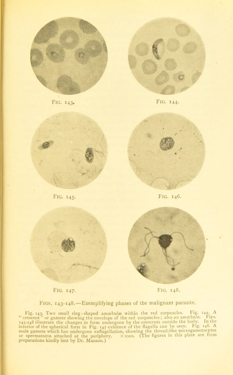 Fig. 143. C Fig. 144. Fig. 147. Fig. 148. Figs. 143-148.—Exemplifying phases of the malignant parasite. Fig. 143. Two small ring-shaped amcebula: within the red corpuscles. I'ig. 144.. A “ crescent ” or gamete showing the envelope of the red corpuscles ; also an amocbula. I* ips. 145-148 illustrate the changes in form undergone by the crescents outside the body. In the interior of the spherical form in Fig. 147 evidence of the flagella can be seen. big. 148. A male gamete which has undergone exflagellation, showing the thread-like microgametocytcs or spermatozoa attached at the periphery. X 1000. (The figures in this plate are from preparations kindly lent by Dr. Manson.)