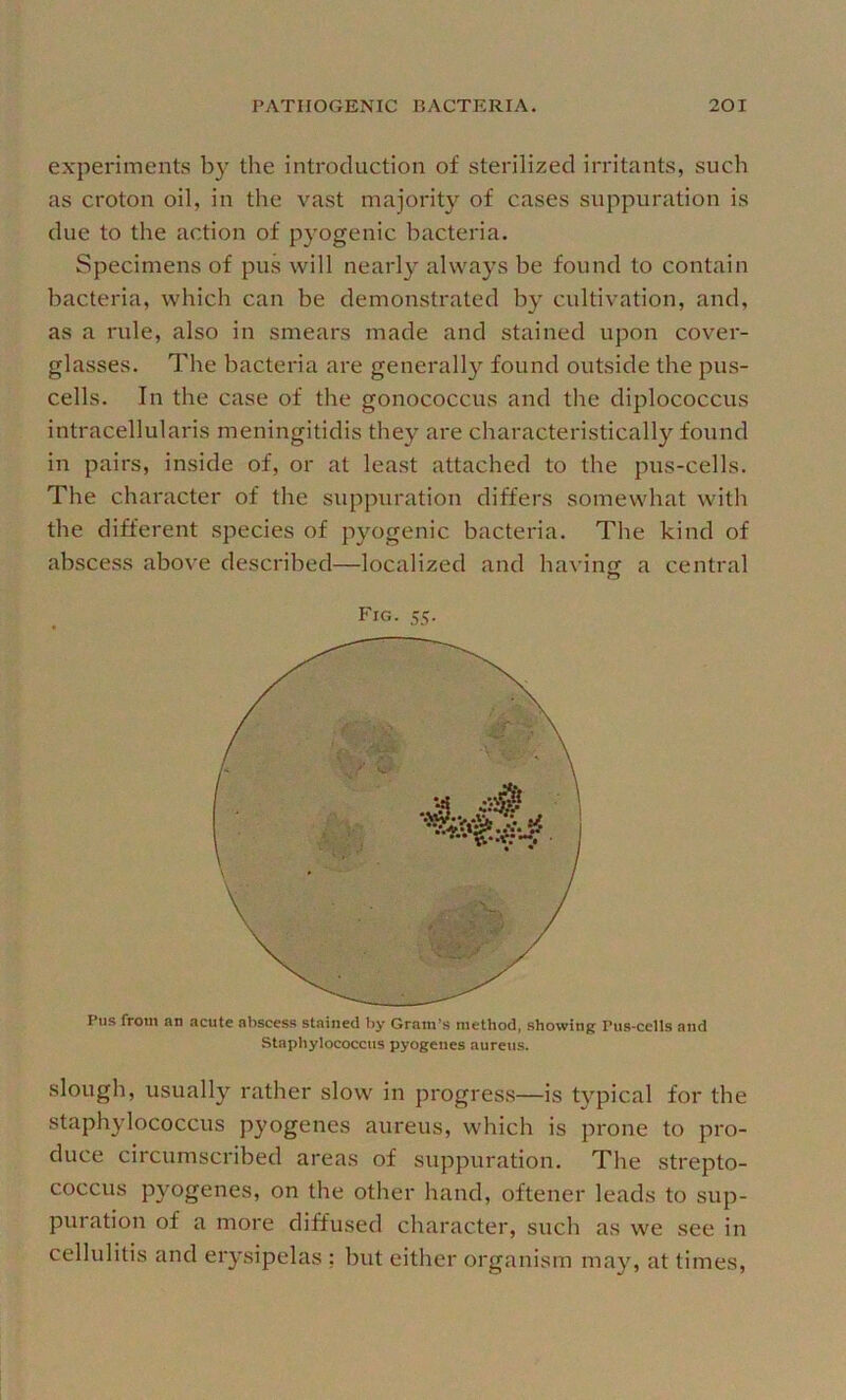 experiments by the introduction of sterilized irritants, such as croton oil, in the vast majority of cases suppuration is due to the action of pyogenic bacteria. Specimens of pus will nearly always be found to contain bacteria, which can be demonstrated by cultivation, and, as a rule, also in smears made and stained upon cover- glasses. The bacteria are generally found outside the pus- cells. In the case of the gonococcus and the diplococcus intracellularis meningitidis they are characteristically found in pairs, inside of, or at least attached to the pus-cells. The character of the suppuration differs somewhat with the different species of pyogenic bacteria. The kind of abscess above described—localized and having a central Fig. 55. Pus from an acute abscess stained by Gram’s method, showing Pus-cells and Staphylococcus pyogenes aureus. slough, usually rather slow in progress—is tvpical for the staphylococcus pyogenes aureus, which is prone to pro- duce circumscribed areas of suppuration. The strepto- coccus pyogenes, on the other hand, oftener leads to sup- puration of a more diffused character, such as we see in cellulitis and erysipelas ; but either organism may, at times.