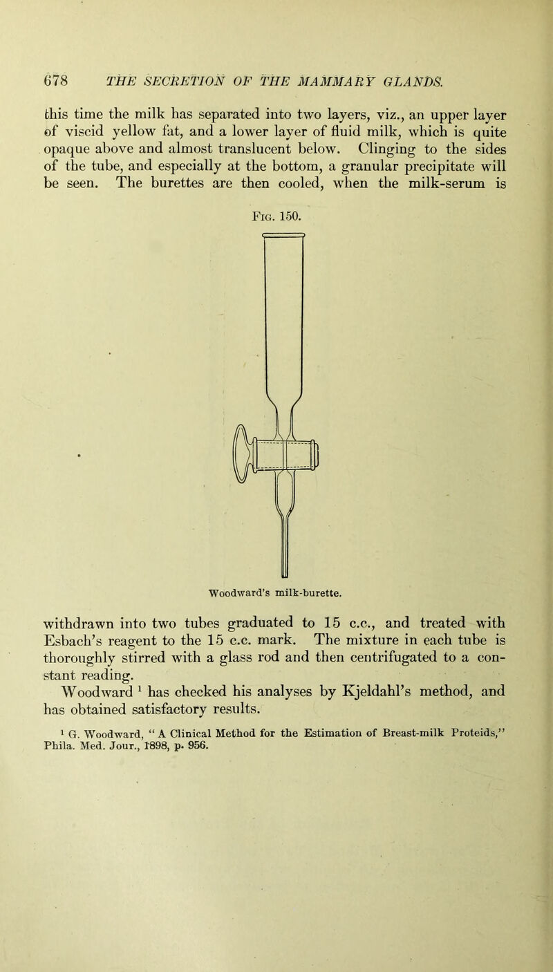 this time the milk has separated into two layers, viz., an upper layer of viscid yellow fat, and a lower layer of fluid milk, which is quite opaque above and almost translucent below. Clinging to the sides of the tube, and especially at the bottom, a granular precipitate will be seen. The burettes are then cooled, when the milk-serum is Fig. 150. Woodward’s milk-burette. withdrawn into two tubes graduated to 15 c.c., and treated with Esbach’s reagent to the 15 c.c. mark. The mixture in each tube is thoroughly stirred with a glass rod and then centrifugated to a con- stant reading. Woodward 1 has checked his analyses by Kjeldahl’s method, and has obtained satisfactory results. 1 G. Woodward, “ A Clinical Method for the Estimation of Breast-milk Proteids,” Phila. Med. Jour., 1'898, p. 956.