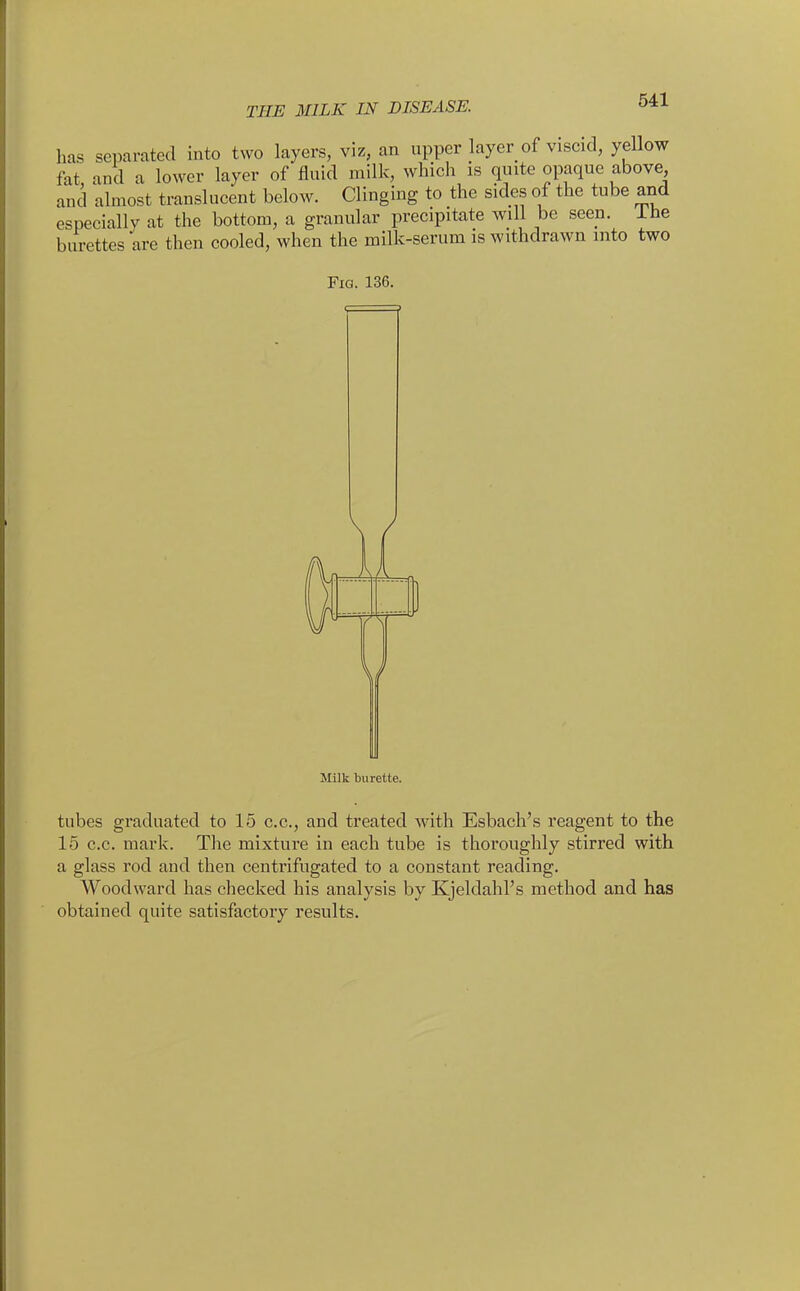 has separated into two layers, viz, an upper layer of viscid, yellow fat and a lower layer of fluid milk, which is quite opaque above and almost translucent below. Clinging to the sides of the tube and especially at the bottom, a granular precipitate will be seen. Ihe burettes are then cooled, when the milk-serum is withdrawn into two Fig. 136. V Milk burette. tubes graduated to 15 c.c, and treated with Esbach's reagent to the 15 c.c. mark. The mixture in each tube is thoroughly stirred with a glass rod and then centrifugated to a constant reading. Woodward has checked his analysis by Kjeldahl's method and has obtained quite satisfactory results.