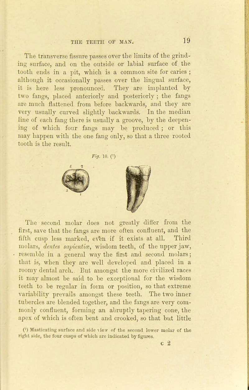 The transverse fissure passes over the limits of the grind- ing surface, and on the outside or labial surface of the tooth ends in a pit, which is a common site for caries ; although it occasionally passes over the lingual surface, it is here less pronounced. They are implanted by two fangs, placed anteriorly and posteriorly ; the fangs are much flattened from before backwards, and they are very usually curved slightly backwards. In the median line of each fang there is usually a groove, by the deepen- ing of which four fangs may be produced ; or this may happen with the one fang only, so that a three rooted tooth is the result. Fig. 10. (') t 2 The second molar does not greatly differ from the first, save that the fangs are more often confluent, and the fifth cusp less marked, even if it exists at all. Third molars, dentes sapientice, wisdom teeth, of the upper jaw, resemble in a general way the first and second molars; that is, when they are well developed and placed in a roomy dental arch. But amongst the more civilized races it may almost he said to be exceptional for the wisdom teeth to be regular in form or position, so that extreme variability prevails amongst these teeth. The two inner tubercles are blended together, and the fangs are very com- monly confluent, forming an abruptly tapering cone, the apex of which is often bent and crooked, so that but little (') Masticating surface and side \ie.v of tlie second lower molar of the right side, the four cusps of which are indicated by figures. c 2