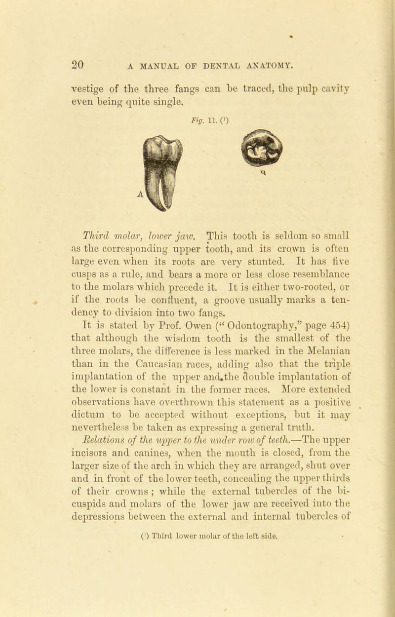 vestige of the three fangs can he traced, the pulp cavity- even being quite single. Fig. 11. (') Third molar, lower jaw. This tooth is seldom so small as the corresponding upper tooth, and its crown is often large even when its roots are very stunted. It has five cusps as a rule, and bears a more or less close resemblance to the molars which precede it. It is either two-rooted, or if the roots be confluent, a groove usually marks a ten- dency to division into two fangs. It is stated by Prof. Owen (“ Odontography,” page 454) that although the wisdom tooth is the smallest of the three molars, the difference is less marked in the Melanian than in the Caucasian races, adding also that the triple implantation of the upper ancLthe double implantation of the lower is constant in the former races. More extended observations have overthrown this statement as a positive dictum to be accepted without exceptions, but it may nevertheless be taken as expressing a general truth. Relations of the upper to the under row of teeth.—The upper incisors and canines, when the mouth is closed, from the larger size of the arch in which they are arranged, shut over and in front of the lower teeth, concealing the upper thirds of their crowns ; while the external tubercles of the bi- cuspids and molars of the lower jaw are received into the depressions between the external and internal tubercles of (') Third lower molar of the left side.