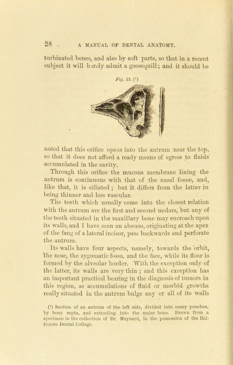 turbinated bones, and also by soft parts, so that in a recent subject it will b irely admit a gooseijuill; and it should be Fig. 13. (') noted that this orifice opens into the antrum near the top, so that it does not afford a ready means of egress to fluids' accumulated in the cavity. Through this orifice the mucous membrane lining the antrum is continuous with that of the nasal fossae, and, like that, it is ciliated ; but it differs from the latter in being thinner and less vascular. The teeth which usually come into the closest relation with the antrum are the first and second molars, but any of the teeth situated in the maxillary bone may encroach upon its walls, and I have seen an abscess, originating at the apex of the fang of a lateral incisor, pass backwards and perforate the antrum. Its walls have four aspects, namely, towards the 'orbit, 'the nose, the zygomatic fossa, and the face, while its floor is formed by the alveolar border. With the exception only of the latter, its walls are very thin ; and this exception has an important practical bearing in the diagnosis of tumors in this region, as accumulations of fluid or morbid growths really situated in the antrum bulge any or all of its walls (') Section of an antrum of the left side, divided into many pouches, by bony septa, and extending into the malar bone. Drawn from a specimen in the collection of Dr. Maynard, in the possession of the Bal- timore Dental College.