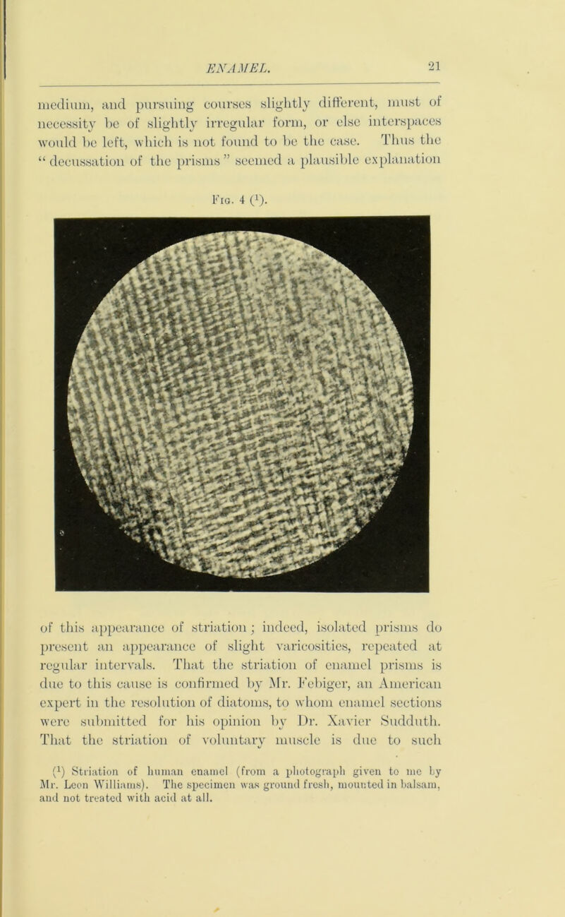 medium, and pursuing courses slightly different, must of necessity be of slightly irregular form, or else interspaces would be left, which is not found to be the case. Thus the “ decussation of the prisms ” seemed a plausible explanation Fig. 4 t1). of this appearance of striation; indeed, isolated prisms do present an appearance of slight varicosities, repeated at regular intervals. That the striation of enamel prisms is due to this cause is confirmed by Mi1. Febiger, an American expert in the resolution of diatoms, to whom enamel sections were submitted for his opinion by Dr. Xavier Sudduth. That the striation of voluntary muscle is due to such (x) Striation of human enamel (from a photograph given to me by Mr. Leon Williams). The specimen was ground fresh, mounted in balsam, and not treated with acid at all.