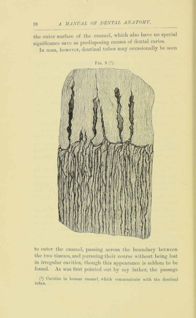 the outer surface of the enamel, which also ha\e no special significance save as predisposing causes of dental cai '.es. In man, however, dentinal tubes may occasionally be seen Fig. 9 {'). to enter the enamel, passing across the boundary between the two tissues, and pursuing their course without being lost in irregular cavities, though this appearance is seldom to be found. As was first pointed out by my father, the passage (’) Cavities in human enamel, which communicate with the dentinal tubes.