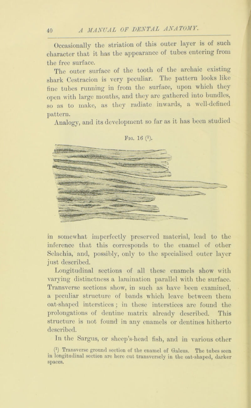 Occasionally the striation of this outer layer is of such character that it has the appearance ot tubes entering fiom the free surface. The outer surface of the tooth of the archaic existing shark Cestracion is very peculiar. The pattern looks like tine tubes running in from the surface, upon which they open with large mouths, and they arc gathered into bundles, so as to make, as they radiate inwards, a well-defined pattern. Analogy, and its development so far as it has been studied Fig. 16 (*). in somewhat imperfectly preserved material, lead to the inference that this corresponds to the enamel of other Selachia, and, possibly, only to the specialised outer layer just described. Longitudinal sections of all these enamels show with varying distinctness a lamination parallel with the surface. Transverse sections show, in such as have been examined, a peculiar structure of bands which leave between them oat-shaped interstices; in these interstices are found the prolongations of dentine matrix already described. This structure is not found in any enamels or dentines hitherto described. In the Sargus, or sheep’s-head fish, and in various other 0) Transverse ground section of the enamel of Galeus. The tubes seen in longitudinal section arc here cut transversely in the oat-shaped, darker spaces.