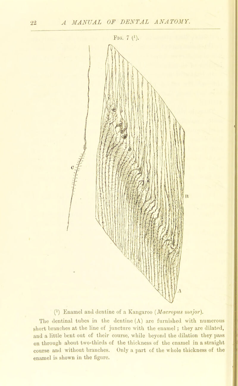 Fig. 7 0). (') Euiimel and dentine of a Kangaroo {Macropm major). Tliu dentinal tubes in the dentine (A) are furnished witli numerous slioit branches at the line of juncture witii tlie enamel ; tliey are dilated, and a little bent out of their course, while beyond the dilation they pass on through about two-thirds of tlie thickness of the enamel in a straight course and without brandies. Only a part of the whole thickness of the enamel is shown in the figure.