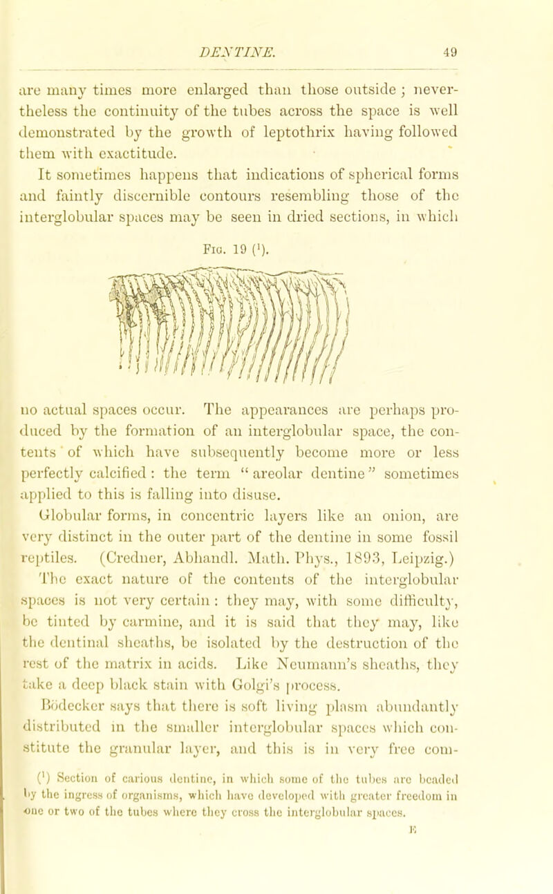 are many times more enlarged than those outside ; never- theless the continuity of the tubes across the space is well demonstrated by the growth of leptothrix having followed them with exactitude. It sometimes happens that indications of spherical foi'ms and faintly discernible contours resembling those of the interglobular spaces may be seen in dried sections, in which Fia. 19 ('). no actual spaces occur. The appearances are perhaps pro- duced by the formation of an interglobidar space, the con- tents of which have subsequently become more or less perfectly calcified : the term  areolar dentine sometimes applied to this is falling into disuse. Globular forms, in concentric layers like an onion, are very distinct in the outer part of the dentine in some fossil reptiles. (Credner, Abhaudl. Math. Phys., 1893, Leipzig.) The exact nature of the contents of the interglobular spaces is not very certain : they may, with some difficulty, be tinted by carmine, and it is said that they may, like the dentinal sheaths, be isolated by the destruction of the rest of the matrix in acids. Like Neumann's sheaths, they take a deep black stain with Golgi's [)rocess. Biklecker says that tiiere is soft living pliisn\ abundantly distributed in tlie smidler interglobular spaces which con- stitute tiic granular layer, and this is in very free com- {') Section of carious (.iciitinc, in which sumo of tho tiil)cs arc bcadeil liy the ingress of organisms, wliicli liavc developed with greater freedom in one or two of tlic tubes wliero tlioy cross tlie interghjbular spaces.