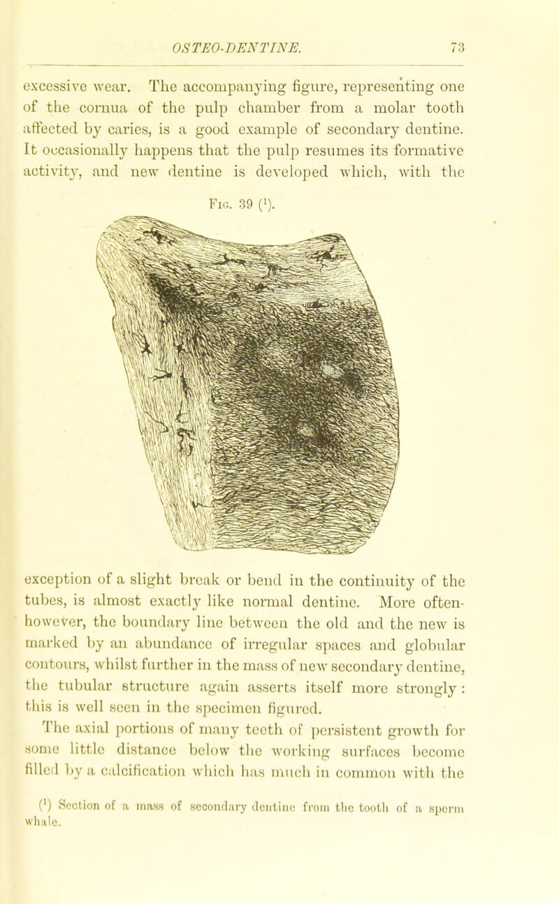 excessive wear. The accompanying figure, representing one of the cornua of the pulp chamber from a molar tooth affected by caries, is a good example of secondary dentine. It occasionally happens that the pulp resumes its formative activity, and new dentine is developed which, with the Fig. 39 ('). exception of a slight break or bend in the continuity of the tubes, is almost exactly like normal dentine. More often- Kowever, the boundary line between the old and the new is marked by an abundance of irregular spaces and globular contours, whilst further in the mass of new secondary dentine, the tubular structure again asserts itself more strongly: this is well seen in the specimen figured. The axial portions of many teeth of persistent growth for some little distance below the working surfaces become filled by a calcification which has much in common with the (') Section of a mass of secondary dentine from the tootli of a spoi'ni wlialc.