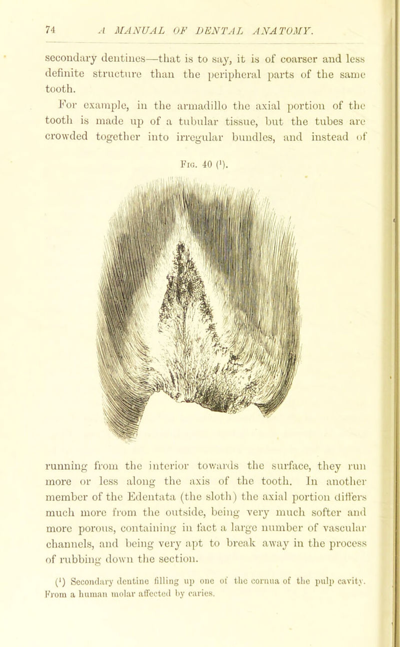 secondary dentines—that is to say, it is of coarser and less definite structure than the peripheral parts of the same tooth. For example, in the armadillo the axial portion of the tooth is made up of a tubular tissue, but the tubes are crowded togetlier into irregular bvuidlcs, and instead of Fig. 40 (i). running from the interior towards the surface, they run more or less along tlie axis of the tooth. In another member of the Edentata (the sloth) the axial portion differs much more from the outside, being very mucli softer ami more porous, containing in fact a large number of vascular channels, and being very apt to break away in the process of rubbing down tiie section. (') Secoiitliiry (leutinc filling up one oi the ooriina of the pulp cavitv. Fjoin a human molar afTectwt by caries.