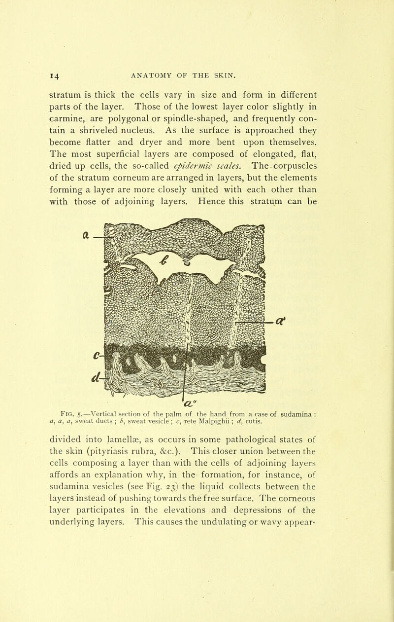 stratum is thick the cells vary in size and form in different parts of the layer. Those of the lowest layer color slightly in carmine, are polygonal or spindle-shaped, and frequently con- tain a shriveled nucleus. As the surface is approached they become flatter and dryer and more bent upon themselves. The most superficial layers are composed of elongated, flat, dried up cells, the so-called epidermic scales. The • corpuscles of the stratum corneum are arranged in layers, but the elements forming a layer are more closely united with each other than with those of adjoining layers. Hence this stratum can be Fig. 5.—Vertical section of the palm of the hand from a case of sudamina : a, a, ii, sweat ducts ; d, sweat vesicle ; c, rete Malpighii; d, cutis. divided into lamellae, as occurs in some pathological states of the skin (pityriasis rubra, &c.). This closer union between the cells composing a layer than with the cells of adjoining layers affords an explanation why, in the formation, for instance, of sudamina vesicles (see Fig. 23) the liquid collects between the layers instead of pushing towards the free surface. The corneous layer participates in the elevations and depressions of the underlying layers. This causes the undulating or wavy appear-