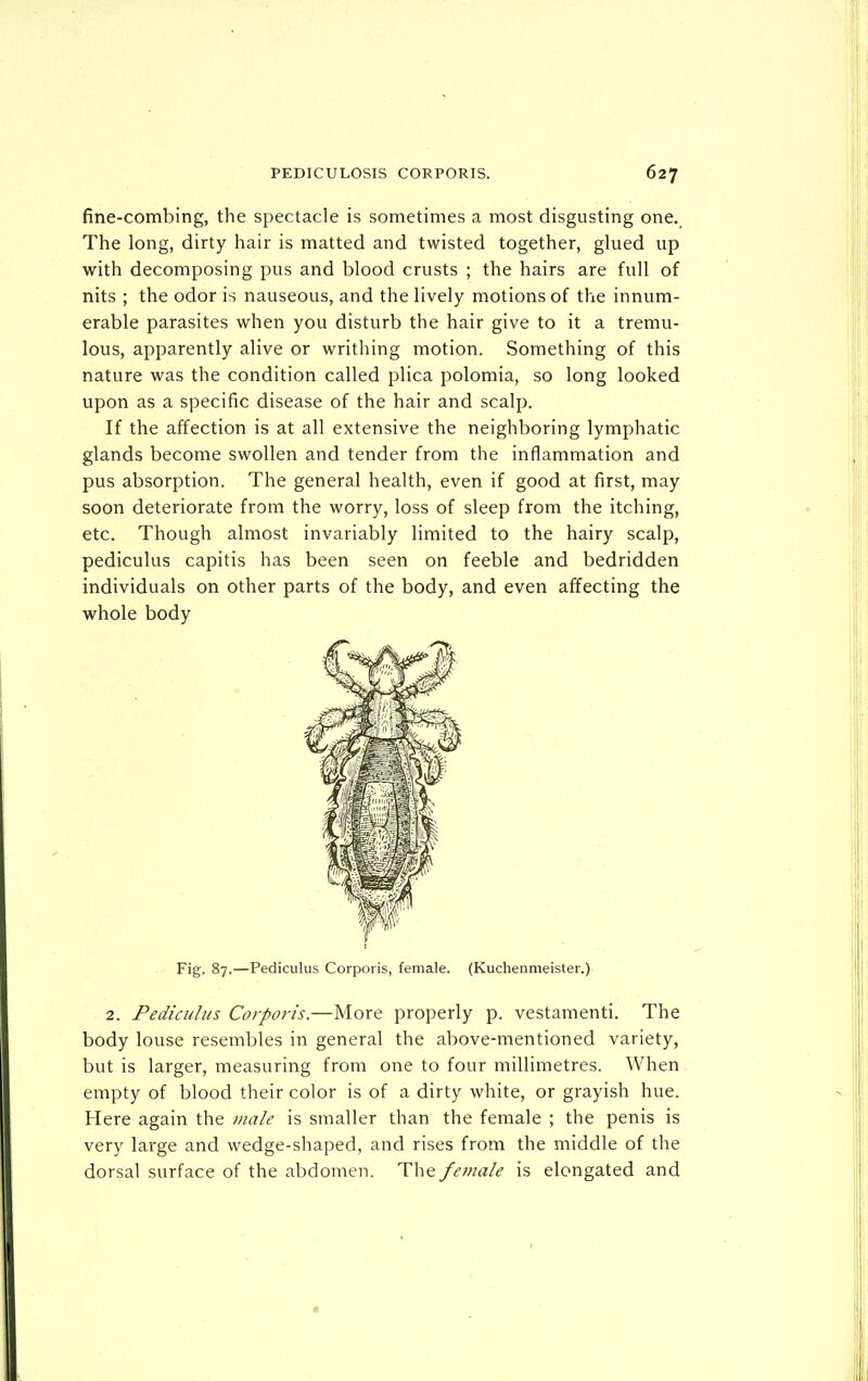 fine-combing, the spectacle is sometimes a most disgusting one. The long, dirty hair is matted and twisted together, glued up with decomposing pus and blood crusts ; the hairs are full of nits ; the odor is nauseous, and the lively motions of the innum- erable parasites when you disturb the hair give to it a tremu- lous, apparently alive or writhing motion. Something of this nature was the condition called plica polomia, so long looked upon as a specific disease of the hair and scalp. If the affection is at all extensive the neighboring lymphatic glands become swollen and tender from the inflammation and pus absorption. The general health, even if good at first, may soon deteriorate from the worry, loss of sleep from the itching, etc. Though almost invariably limited to the hairy scalp, pediculus capitis has been seen on feeble and bedridden individuals on other parts of the body, and even affecting the whole body Fig. 87.—Pediculus Corporis, female. (Kuchenmeister.) 2. Pediculus Corporis.—More properly p. vestamenti. The body louse resembles in general the above-mentioned variety, but is larger, measuring from one to four millimetres. When empty of blood their color is of a dirty white, or grayish hue. Here again the male is smaller than the female ; the penis is very large and wedge-shaped, and rises from the middle of the dorsal surface of the abdomen. The feitiale is elongated and