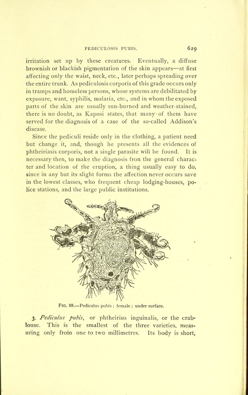 irritation set up by these creatures. Eventually, a diffuse brownish or blackish pigmentation of the skin appears—at first affecting only the waist, neck, etc., later perhaps spreading over the entire trunk. As pediculosis corporis of this grade occurs only in tramps and homeless persons, whose systems are debilitated by exposure, want, syphilis, malaria, etc., and in whom the exposed parts of the skin are usually sun-burned and weather-stained, there is no doubt, as Kaposi states, that many of them have served for the diagnosis of a case of the so-called Addison's disease. Since the pediculi reside only in the clothing, a patient need but change it, and, though he presents all the evidences of phtheiriasis corporis, not a single parasite will be found. It is necessary then, to make the diagnosis fron the general charac- ter and location of the eruption, a thing usually easy to do, since in any but its slight forms the affection never occurs save in the lowest classes, who frequent cheap lodging-houses, po- lice stations, and the large public institutions. Fig. 88.—Pediculus pubis ; female ; under surface. 3. Pediculus pubis, or phtheirius inguinalis, or the crab- louse. This is the smallest of the three varieties, meas- uring only from one to two millimetres. Its body is short,