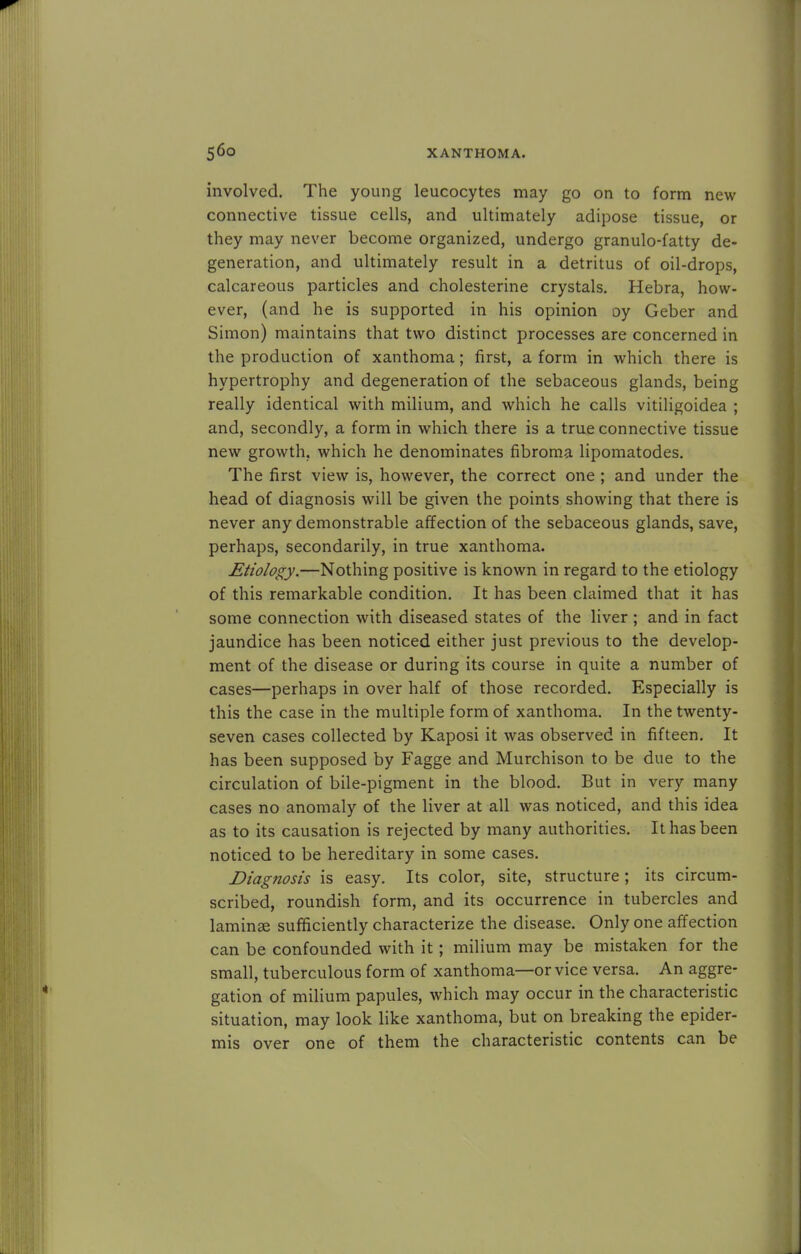 involved. The young leucocytes may go on to form new connective tissue cells, and ultimately adipose tissue, or they may never become organized, undergo granulo-fatty de- generation, and ultimately result in a detritus of oil-drops, calcareous particles and cholesterine crystals. Hebra, how- ever, (and he is supported in his opinion oy Geber and Simon) maintains that two distinct processes are concerned in the production of xanthoma; first, a form in which there is hypertrophy and degeneration of the sebaceous glands, being really identical with milium, and which he calls vitiligoidea ; and, secondly, a form in which there is a true connective tissue new growth, which he denominates fibroma lipomatodes. The first view is, however, the correct one ; and under the head of diagnosis will be given the points showing that there is never any demonstrable affection of the sebaceous glands, save, perhaps, secondarily, in true xanthoma. Etiology.—Nothing positive is known in regard to the etiology of this remarkable condition. It has been claimed that it has some connection with diseased states of the liver ; and in fact jaundice has been noticed either just previous to the develop- ment of the disease or during its course in quite a number of cases—perhaps in over half of those recorded. Especially is this the case in the multiple form of xanthoma. In the twenty- seven cases collected by Kaposi it was observed in fifteen. It has been supposed by Fagge and Murchison to be due to the circulation of bile-pigment in the blood. But in very many cases no anomaly of the liver at all was noticed, and this idea as to its causation is rejected by many authorities. It has been noticed to be hereditary in some cases. Diagnosis is easy. Its color, site, structure; its circum- scribed, roundish form, and its occurrence in tubercles and laminse sufficiently characterize the disease. Only one affection can be confounded with it; milium may be mistaken for the small, tuberculous form of xanthoma—or vice versa. An aggre- gation of milium papules, which may occur in the characteristic situation, may look like xanthoma, but on breaking the epider- mis over one of them the characteristic contents can be