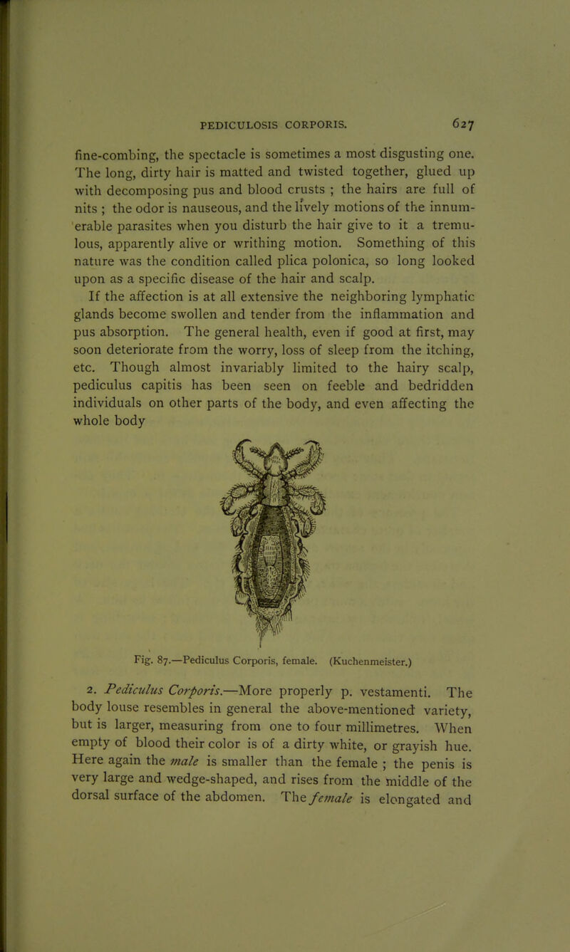 fine-combing, the spectacle is sometimes a most disgusting one. The long, dirty hair is matted and twisted together, glued up with decomposing pus and blood crusts ; the hairs are full of nits ; the odor is nauseous, and the lively motions of the innum- erable parasites when you disturb the hair give to it a tremu- lous, apparently alive or writhing motion. Something of this nature was the condition called plica polonica, so long looked upon as a specific disease of the hair and scalp. If the affection is at all extensive the neighboring lymphatic, glands become swollen and tender from the inflammation and pus absorption. The general health, even if good at first, may soon deteriorate from the worry, loss of sleep from the itching, etc. Though almost invariably limited to the hairy scalp, pediculus capitis has been seen on feeble and bedridden individuals on other parts of the body, and even affecting the whole body Fig. 87.—Pediculus Corporis, female. (Kuchenmeister.) 2. Pediculus Corporis.—More properly p. vestamenti. The body louse resembles in general the above-mentioned variety, but is larger, measuring from one to four millimetres. When empty of blood their color is of a dirty white, or grayish hue. Here again the male is smaller than the female ; the penis is very large and wedge-shaped, and rises from the middle of the dorsal surface of the abdomen. The female is elongated and