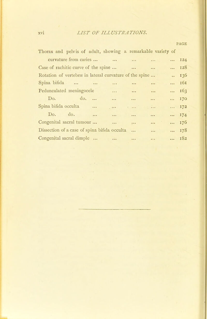 PAGE Thorax and pelvis of adult, showing a remarkable variety of curvature from caries ... ... ... ... ... 124 Case of rachitic curve of the spine ... ... ... ... 128 Rotation of vertebra in lateral curvature of the spine ... .. 136 Spina bifida ... ... ... ... ... ... 161 Pedunculated meningocele ... ... ... ... 163 Do. do. ... ... ... ... ... 170 Spina bifida occulta ... ... , ... ... ... 172 Do. do. ... ... ... ... ... 174 Congenital sacral tumour ... ... ... ... ... 176 Dissection of a case of spina bifida occulta ... ... ... 178 Congenital sacral dimple ... ... ... ... ... 182