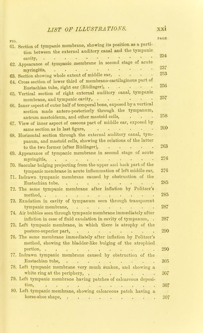 nu. ... 61. Section of tympanic membrane, showing its position as a parti- tion between the external auditory canal and the tympanic cavity, _ 62. Appearance of tympanic membrane in second stage of acute myringitis, 63. Section showing whole extent of middle ear, 64. Cross section of lower third of membrano-cartilaginous part of Eustachian tube, right ear (Riidinger), . 65. Vertical section of right external auditory canal, tympanic membrane, and tympanic cavity,. .••••• 66. Inner aspect of outer half of temporal bone, exposed by a vertical section made antero-posteriorly through the tympanum, antrum mastoideum, and other mastoid cells, 67. View of inner aspect of osseous part of middle ear, exposed by same section as in last figure, 68. Horizontal section through the external auditory canal, tym- panum, and mastoid cells, showing the relations of the latter to the two former (after Riidinger), ..... 69. Appearance of tympanic membrane in second stage of acute myringitis, 70. Saccular bulging projecting from the upper and back part of the tympanic membrane in acute inflammation of left middle ear, 71. Indrawn tympanic membrane caused by obstruction of the Eustachian tube, • 72. The same tympanic membrane after inflation by Politzer’s method, 73. Exudation in cavity of tympanum seen through transparent tympanic membrane, 74. Air bubbles seen through tympanic membrane immediately after inflation in case of fluid exudation in cavity of tympanum, . 75. Left tympanic membrane, in which there is atrophy of the postero-superior part, 76. The same membrane immediately after inflation by Politzer’s method, showing the bladder-like bulging of the atrophied portion, 77. Indrawn tympanic membrane caused by obstruction of the Eustachian tube, 78. Left tympanic membrane very much sunken, and showing a white ring at the periphery, 79. Left tympanic membrane having patches of calcareous deposi- tion, 80. Left tympanic membrane, showing calcareous patch having a horse-shoe shape, PAGE 234 237 253 256 257 258 260 263 276 276 285 285 287 287 290 290 305 307 307 307