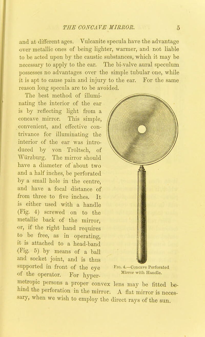 THE CONCAVE MIRROR. o and at different ages. Vulcanite specula have the advantage ■over metallic ones of being lighter, warmer, and not liable to be acted upon by the caustic substances, which it may be necessary to apply to the ear. The bi-valve aural speculum possesses no advantages over the simple tubular one, while it is apt to cause pain and injury to the ear. For the same reason long specula are to be avoided. The best method of illumi- nating the interior of the ear is by reflecting light from a concave mirror. This simple, convenient, and effective con- trivance for illuminating the interior of the ear was intro- duced by von Troltsch, of Wurzburg. The mirror should have a diameter of about two and a half inches, be perforated by a small hole in the centre, and have a focal distance of from three to five inches. It is either used with a handle (Fig. 4) screwed on to the metallic back of the mirror, or, if the right hand requires to be free, as in operating, it is attached to a head-band {Fig. 5) by means of a ball and socket joint, and is thus supported in front of the eye of the operator. For hyper- metropic persons a proper convex lens may be fitted be- hind the perforation in the mirror. A flat mirror is neces- sary, when we wish to employ the direct rays of the sun. Fio. 4.—Concave Perforated Mirror with Handle.