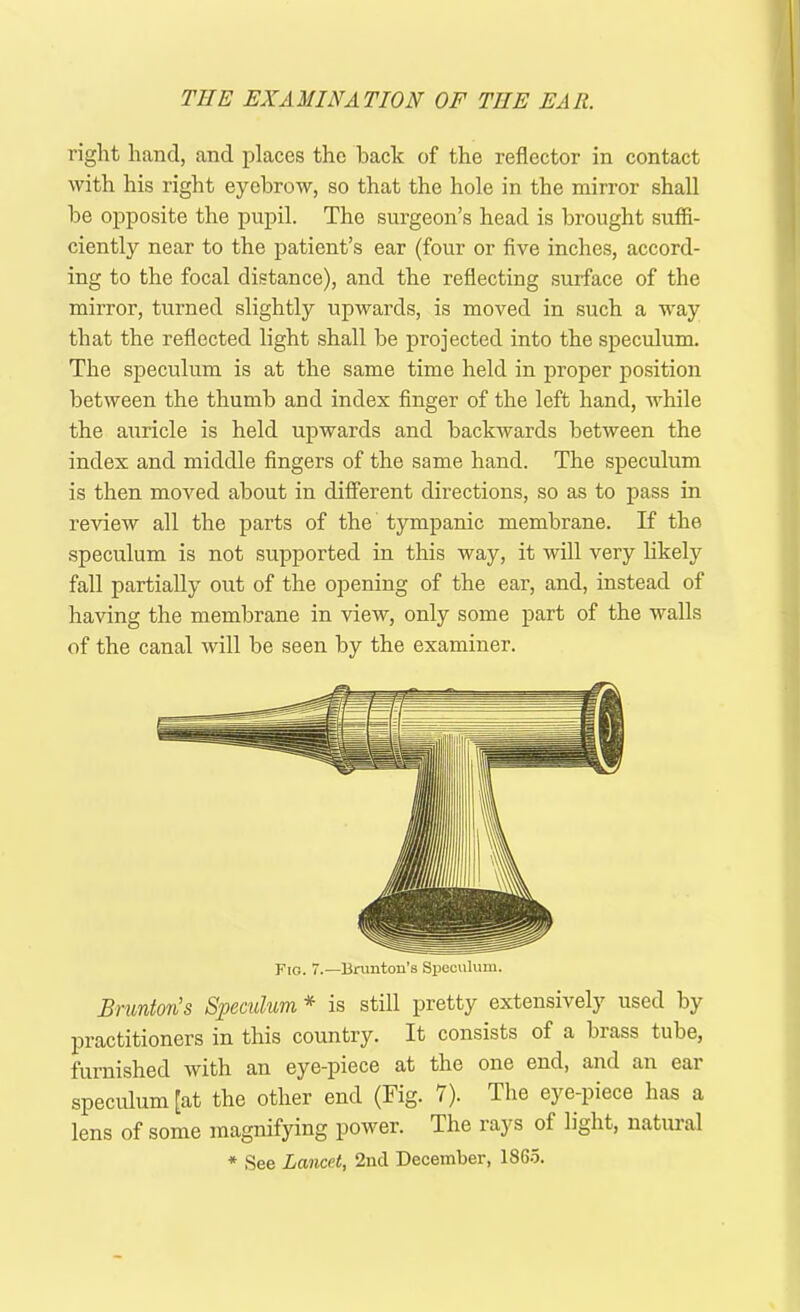 right hand, and places the back of the reflector in contact with his right eyebrow, so that the hole in the mirror shall be opposite the pupil. The surgeon’s head is brought suffi- ciently near to the patient’s ear (four or five inches, accord- ing to the focal distance), and the reflecting surface of the mirror, turned slightly upwards, is moved in such a way that the reflected light shall be projected into the speculum. The speculum is at the same time held in proper position between the thumb and index finger of the left hand, while the auricle is held upwards and backwards between the index and middle fingers of the same hand. The speculum is then moved about in different directions, so as to pass in review all the parts of the tympanic membrane. If the speculum is not supported in this way, it will very likely fall partially out of the opening of the ear, and, instead of having the membrane in view, only some part of the walls of the canal will be seen by the examiner. Brunton’s Speculum * is still pretty extensively used by practitioners in this country. It consists of a brass tube, furnished with an eye-piece at the one end, and an ear speculum [at the other end (Fig. 7). The eye-piece has a lens of some magnifying power. The rays of light, natuial * See Lancet, 2nd December, 1865.