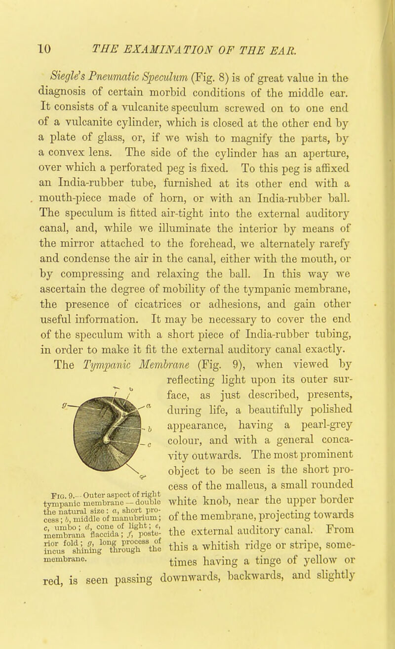Siegle’s Pneumatic Speculum (Fig. 8) is of great value in the diagnosis of certain morbid conditions of the middle ear. It consists of a vulcanite speculum screwed on to one end of a vulcanite cylinder, which is closed at the other end by a plate of glass, or, if we wish to magnify the parts, by a convex lens. The side of the cylinder has an aperture, over which a perforated peg is fixed. To this peg is affixed an India-rubber tube, furnished at its other end with a mouth-piece made of horn, or with an India-rubber ball. The speculum is fitted air-tight into the external auditor}' canal, and, while we illuminate the interior by means of the mirror attached to the forehead, we alternately rarefy and condense the air in the canal, either with the mouth, or by compressing and relaxing the ball. In this way we ascertain the degree of mobility of the tympanic membrane, the presence of cicatrices or adhesions, and gain other useful information. It may be necessary to cover the end of the speculum with a short piece of India-rubber tubing, in order to make it fit the external auditory canal exactly. The Tympanic Membrane (Fig. 9), when viewed by reflecting light upon its outer sur- face, as just described, presents, during life, a beautifully polished appearance, having a pearl-grey colour, and with a general conca- vity outwards. The most prominent object to be seen is the short pro- cess of the malleus, a small rounded white knob, near the upper border of the membrane, projecting towards the external auditory canal. From this a whitish ridge or stripe, some- times having a tinge of yellow or downwards, backwards, and slightly Fig. 9.- Outer aspect of right tympanic membrane — double the natural size : a, short pro- cess ; b, middle of manubrium; c, umbo; d, cone of light; e, membraua flaccida; f, poste- rior fold; g, long process of incus shining through the membrane. red, is seen passing