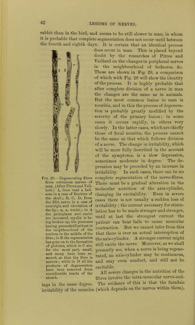 A rabbit thau in the bird, and seems to be still slower in man, in whom it is probable that complete segmentation does not occur until between the fourth and eighth days. It is certain that an identical process does occur in man. This is placed beyond doubt by the researches of Pitres and Yaillard on the changes in peripheral nerves in the neighbourhood of bedsores, &c. These are shown in Fig. 29, a comparison of which with Fig. 28 will show the identity of the process. It is highly probable that after complete division of a nerve in man the changes are the same as in animals. But the most common lesion in man is neuritis, and in this the process of degenera- •v/ i tion is probably greatly modified by the severity of the primary lesion; in some cases it occurs rapidly, in others very slowly. In the latter cases, which are chiefly those of focal neuritis, the process cannot be the same as that which follows division of a nerve. The change in irritability, which will be more fully described in the account of the symptoms, is a slow depression, sometimes moderate in degree. The de- pression may be preceded by an increase in irritability. In such cases, there can be no Fio. 29.—Degenerating fibres complete segmentation of the nerve-fibres. from cutaneous nerves of rp^ere must be a gradual alteration in the man. (After Pitres and Vail- , , ^ j. ,i ■ t j l«rd.) A, from near a bed- molecular nutrition of the axis-cylmder, sore in a case of fracture of changing its excitability. Even in severe the skull; B, C. D. from ^ • ^ ^^^^^ ^ ^^^^^^ j^^g the fifth nerve in a case of ^'^^ J neuralgia and ulceration of irritability ; the current necessary for stimu- the lip; n, n, nuclei; in A ia,tion has to be made stronger and stronger, Se i^crtasld, myelin 'i be- until at last the strongest current the ing broken up, the processes patient can bear fails to cause muscular having proceeded furthest in ^ ^ioj^ B^t we cannot infer from this the neighbourhood of the ^ .!•..•<; nucleus in the middle of the that there is ever an actual interruption ot fibre ; in B the segmentation axis-cvlinder. A stronger current might orgi:r;i:r:ii^i in'c lit stiH excite the nerve. Moreover, as we shall for the most part, small, presently see, when a nei-ve is being regene- and many have been re moved, so that the fibre is narrow; while in D all the products of degeneration have been removed from considerable tracts of the sheath. ings in the same degree. rated, an axis-cylinder may be continuous, and may even conduct, and still not bo excitable. All severe changes in the nutrition of the fibres involve the intra-muscular nerve-end- The evidence of this is that the faradaic irritabUity of the muscles (which depends on the nerves within them),