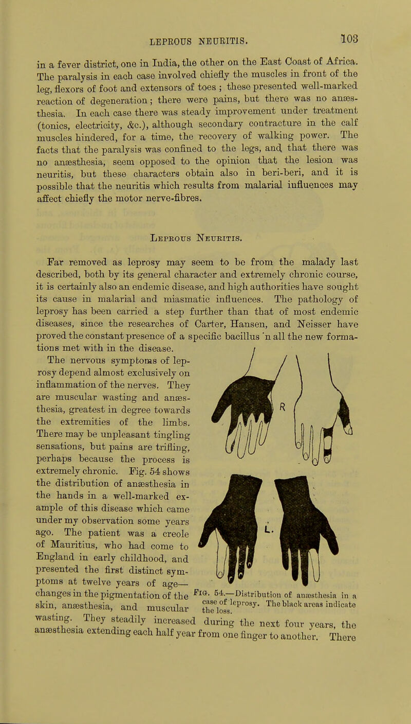 LEPROUS NEURITIS. in a fever district, one in India, tlie other on the East Coast of Africa. The paralysis in each case involved chiefly the muscles in front of the leg, flexors of foot and extensors of toes ; these presented well-marked reaction of degeneration; there were pains, but there was no anajs- thesia. In each case there was steady improvement under treatment (tonics, electricity, &c.), although secondary contracture in the calf muscles hindei-ed, for a time, the recovery of walking power. The facts that the paralysis was confined to the legs, and that there was no ansesthesia, seem opposed to the opinion that the lesion was neuritis, but these characters obtain also in beri-beri, and it is possible that the neuritis which results from malarial influences may afEect chiefly the motor nerve-fibres. Lepeotts Nettritis. Far removed as leprosy may seem to bo from the malady last described, both by its general character and extremely chronic course, it is certainly also an endemic disease, and high authorities have sought its cause in malarial and miasmatic influences. The pathology of leprosy has been carried a step further than that of most endemic diseases, since the researches of Carter, Hansen, and Neisser have proved the constant presence of a specific bacillus 'n all the new forma- tions met with in the disease. The nervous sympfconas of lep- rosy depend almost exclusively on inflammation of the nerves. They are muscular wasting and anaes- thesia, greatest in degree towards the extremities of the limbs. There may be unpleasant tingling sensations, but pains are trifling, perhaps because the process is extremely chronic. Pig. 54 shows the distribution of anaesthesia in the hands in a well-marked ex- ample of this disease which came under my observation some years ago. The patient was a Creole of Mauritius, who had come to England in early childhood, and presented the first distinct sym- ptoms at twelve years of age— changes in the pigmentation of the ^4.—Distribution of anajsthesia in a skin, anaesthesia, and muscular t7/,°f^^^P'-°«y- The black areas indicate wasting. They steadily increased during the next four years, the anaesthesia extending each half year from one finger to another. There