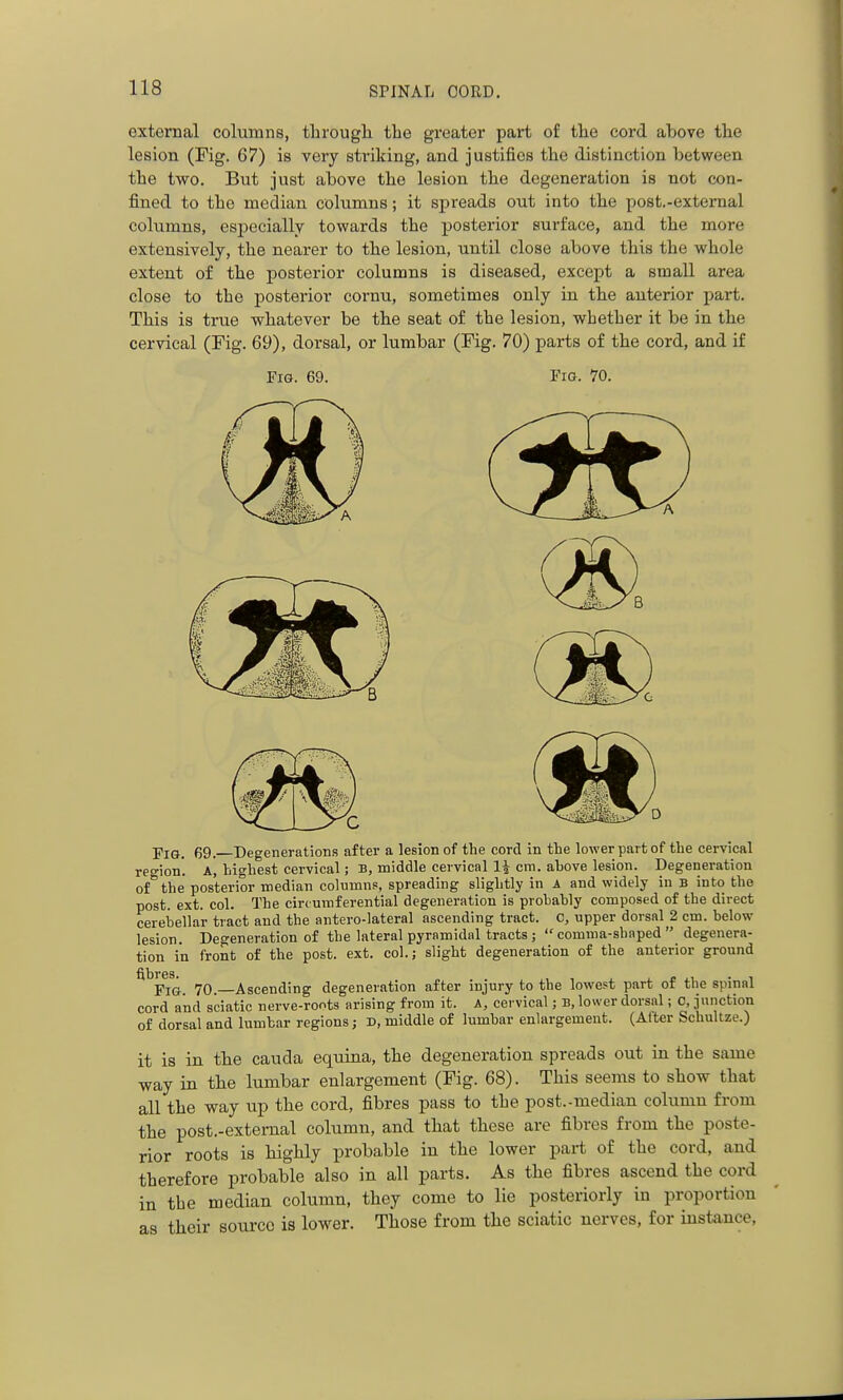 external columns, tlirougb. the greater part of the cord above the lesion (Fig. 67) is very striking, and justifies the distinction between the two. But just above the lesion the degeneration is not con- fined to the median columns; it spreads out into the post.-extemal columns, especially towards the posterior surface, and the more extensively, the nearer to the lesion, until close above this the whole extent of the posterior columns is diseased, except a small area close to the posterior cornu, sometimes only in the anterior part. This is true whatever be the seat of the lesion, whether it be in the cervical (Fig. 69), dorsal, or lumbar (Fig. 70) parts of the cord, and if Fig. 69. Fio. 70. -pia. 69. Degenerations after a lesion of the cord in the lower part of the cervical region'. A, highest cervical; B, middle cervical 1^ era. ahove lesion. Degeneration of the posterior median columns, spreading slightly in A and widely in b into the post. ext. col. The circumferential degeneration is prohahly composed of the direct cerebellar tract and the antero-lateral ascending tract. C, upper dorsal 2 cm. below lesion. Degeneration of the lateral pyramidal tracts ; comma-shaped degenera- tion in front of the post. ext. col.; slight degeneration of the anterior ground Pi&. 70.—Ascending degeneration after injury to the lowest part of the spinal cord and sciatic nerve-roots arising from it. A, cervical; B, lower dorsal; 0, junction of dorsal and lumbar regions; D, middle of lumbar enhirgement. (Alter Schultze.) it is in the cauda equina, the degeneration spreads out in the same way in the lumbar enlargement (Fig. 68). This seems to show that all the way up the cord, fibres pass to the post.-median column from the post.-extemal column, and that these are fibres from the poste- rior roots is highly probable in the lower part of the cord, and therefore probable also in all parts. As the fibres ascend the cord in the median column, they come to lie posteriorly in proportion as their source is lower. Those from the sciatic nerves, for instance,