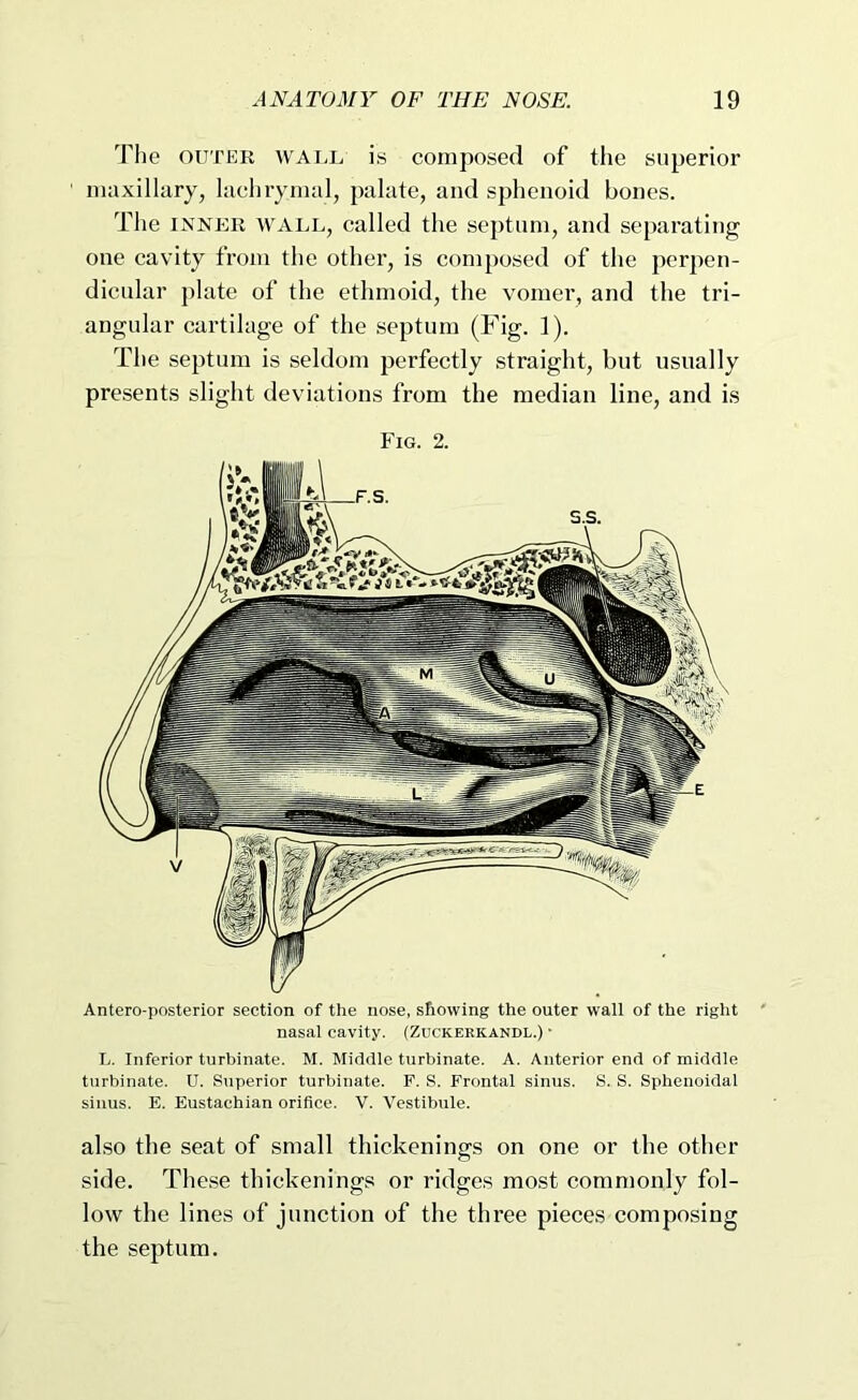 Tlie OUTER WALL is composed of the superior maxillary, lachrymal, palate, and sphenoid bones. The ls^nj<:r wall, called the septum, and separating one cavity from the other, is composed of the perpen- dicular plate of the ethmoid, the vomer, and the tri- angular cartilage of the septum (Fig. 1). The septum is seldom perfectly straight, but usually presents slight deviations from the median line, and is Fig. 2. Antero-posterior section of the nose, showing the outer wall of the right nasal cavity. (Zuckeekandl.) ■ L. Inferior turbinate. M. Middle turbinate. A. Anterior end of middle turbinate. U. Superior turbinate. F. S. Frontal sinus. S. S. Sphenoidal sinus. E. Eustachian orifice. V. Vestibule. also the seat of small thickenings on one or the other side. These thickenings or ridges most commonly fol- low the lines of junction of the three pieces composing the septum.