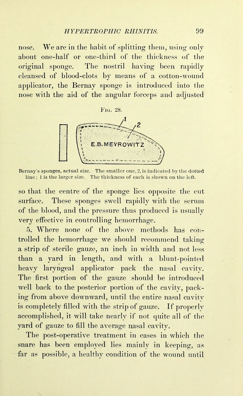 nose. We are in the habit of splitting tlieni, using only about one-half or one-third of the thickness of the original sponge. The nostril having been rapidly cleansed of blood-clots by means of a cotton-wound applicator, the Bernay sponge is introduced into the nose with the aid of the angular forceps and adjusted Fig. 28. Bernay’s sponges, actual size. The smaller one, 2, is indicated l)v tlie dotted line; 1 is the larger size. The thickness of each is shown on the left. so that the centre of the sponge lies opjiosite the cut surface. These sponges swell rapidly with the serum of the blood, and the pressure thus produced is usually very effective in controlling hemorrhage. 5. Where none of the above methods has coi- trolled the hemorrhage we should recommend taking a strip of sterile gauze, an inch in width and not less than a yard in length, and with a blunt-pointed heavy laryngeal applicator pack the nasal cavity. The first portion of the gauze should be introduced well back to the posterior portion of the cavity, pack- ing from above downward, until the entire nasal cavitv is completely filled with the strip of gauze. If properly accompli.shed, it will take nearly if not quite all of the yard of gauze to fill the average nasal cavity. The post-operative treatment in cases in which the snare has been employed lies mainly in keeping, as far as possible, a healthy condition of the wound until