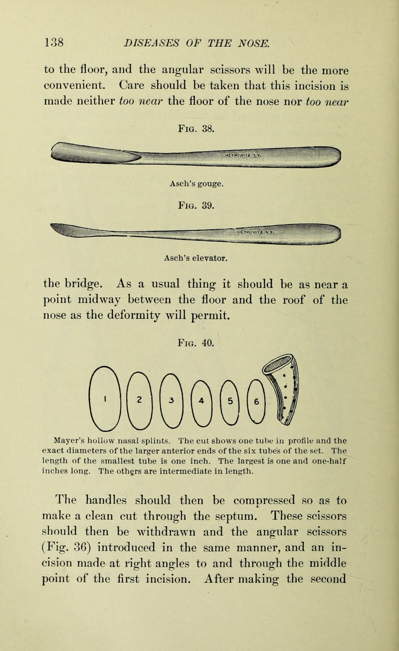 to the floor, and the angular scissors will be the more convenient. Care should he taken that this incision is made neither too near the floor of the nose nor too near Fig. 38. Asch’s gouge. Fig. 39. Asch’s elevator. the bridge. As a usual thing it should be as near a point midway between the floor and the roof of the nose as the deformity will permit. Fig. 40. Mayer’s hollow nasal splints. The cut shows one tube in profile and the exact diameters of the larger anterior ends of the six tubes of the set. The length of the smallest tube is one inch. The largest is one and one-half inches long. The othgrs are intermediate in length. The handles should then be compressed so as to make a clean cut through the septum. These scissors should then be withdrawn and the angular scissors (Fig. 36) introduced in the same manner, and an in- cision made at right angles to and through the middle point of the first incision. After making the second