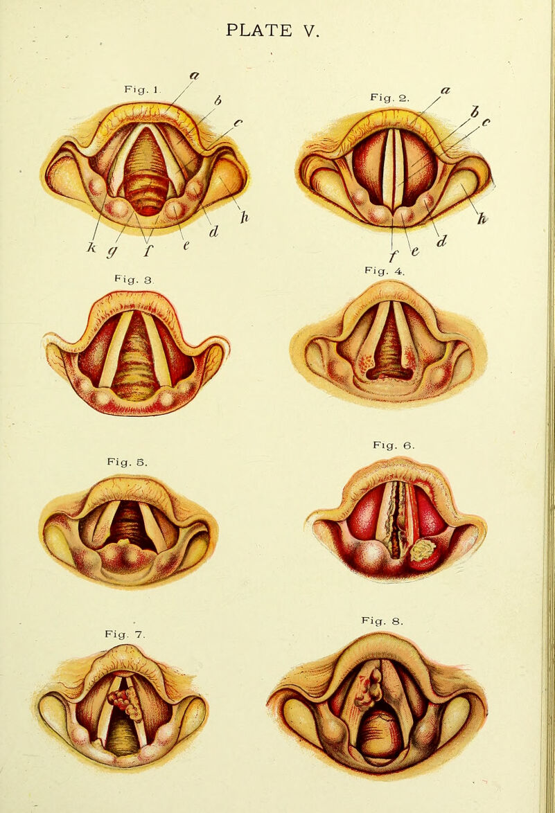 PLATE V. Pig. 6. Fig. 6. Fig. 8. Fig. 7.