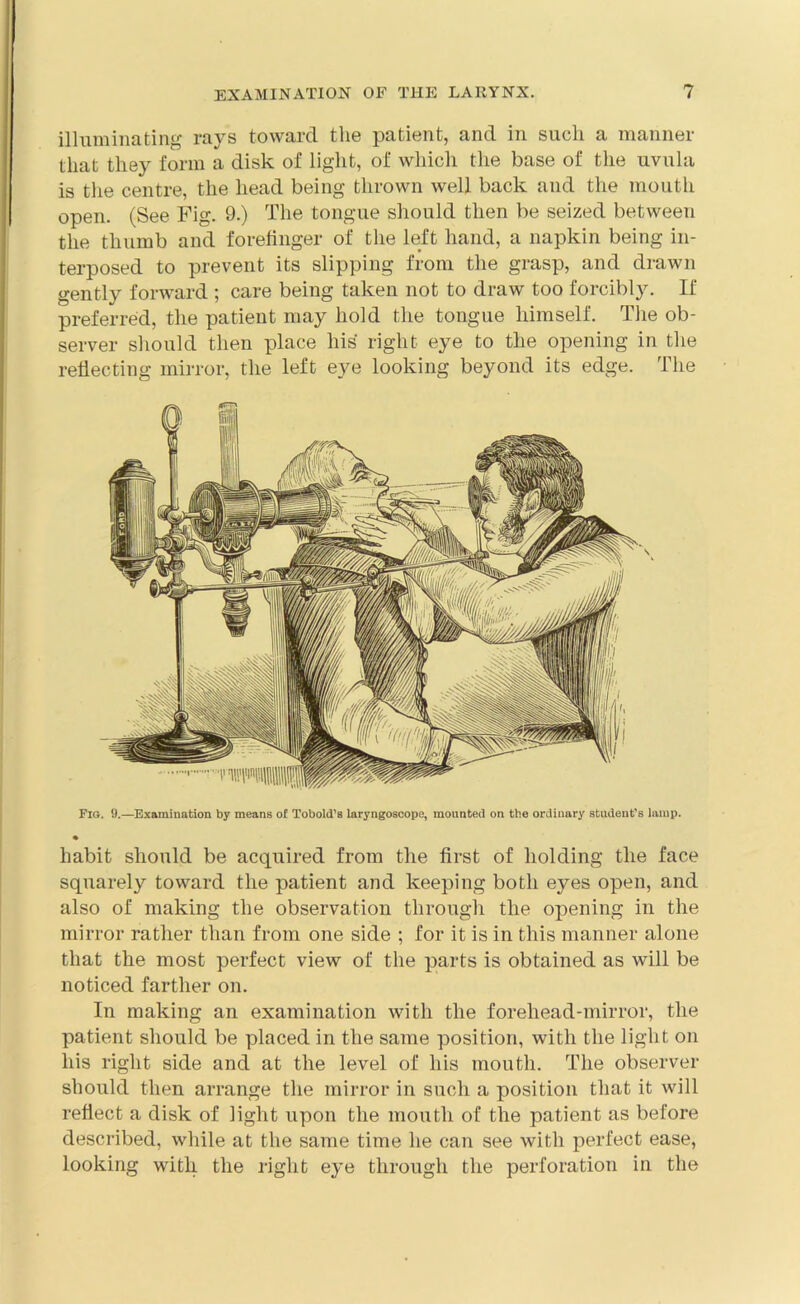 illuminating rays toward the patient, and in such a manner that they form a disk of light, of which the base of the uvula is the centre, the head being thrown well back and the mouth open. (See Fig. 9.) The tongue should then be seized between the thumb and forefinger of the left hand, a napkin being in- terposed to prevent its slipping from the grasp, and drawn gently forward ; care being taken not to draw too forcibly. If preferred, the patient may hold the tongue himself. The ob- server should then place his right eye to the opening in the reflecting mirror, the left eye looking beyond its edge. The Fig. 9.—Examination by means of Tobold’s laryngoscope, mounted on the ordinary student’s lamp. • habit should be acquired from the first of holding the face squarely toward the patient and keeping both eyes open, and also of making the observation through the opening in the mirror rather than from one side ; for it is in this manner alone that the most perfect view of the parts is obtained as will be noticed farther on. In making an examination with the forehead-mirror, the patient should be placed in the same position, with the light on his right side and at the level of his mouth. The observer should then arrange the mirror in such a position that it will reflect a disk of light upon the mouth of the patient as before described, while at the same time he can see with perfect ease, looking with the right eye through the perforation in the