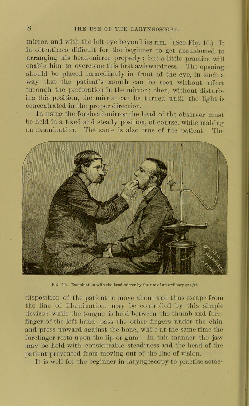 mirror, and with the left eye beyond its rim. (See Fig. 10.) It is oftentimes difficult for the beginner to get accustomed to arranging his head-mirror properly ; but a little practice will enable him to overcome this first awkwardness. The opening should be placed immediately in front of the eye, in such a way that the patient’s mouth can be seen without effort through the perforation in the mirror; then, without disturb- ing this position, the mirror can be turned until the' light is concentrated in the proper direction. In using the forehead-mirror the head of the observer must be held in a fixed and steady position, of course, while making an examination. The same is also true of the patient. The Fig. 10.—Examination with the head-mirror by the use of an ordinary gas-jet. disposition of the patient to move about and thus escape from the line of illumination, may be controlled by this simple device: while the tongue is held between the thumb and fore- finger of the left hand, pass the other lingers under the chin and press upward against the bone, while at the same time the forefinger rests upon the lip or gum. In this manner the jaw may be held with considerable steadiness and the head of the patient prevented from moving out of the line of vision. It is well for the beginner in laryngoscopy to practise some-